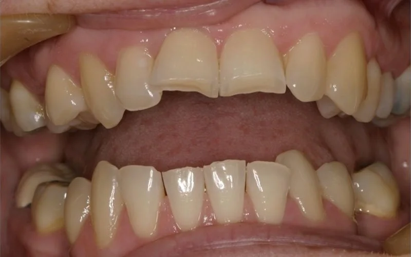 Ortho-Before-800_60.jpg