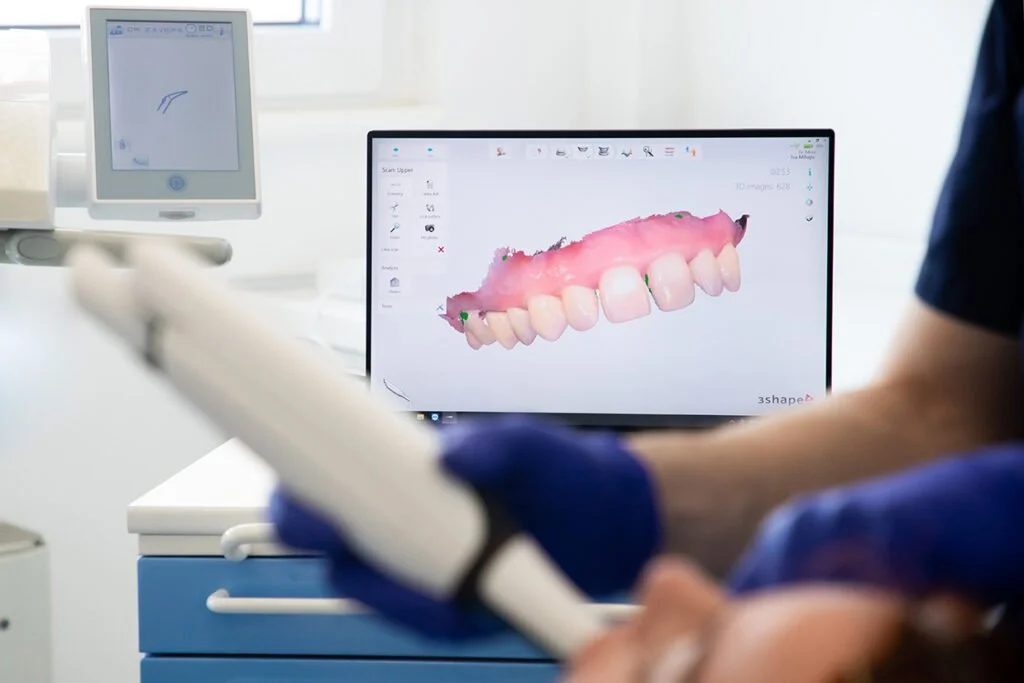 Introducing Trios Intraoral Scanner: Dental Implants Guide