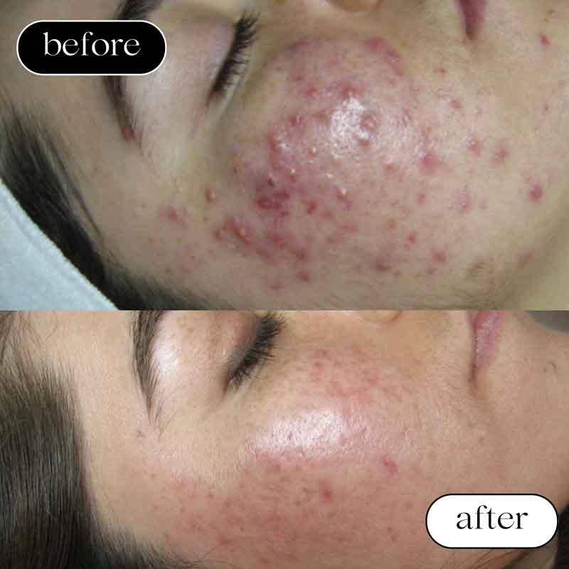 Face Reality Before & After.jpg