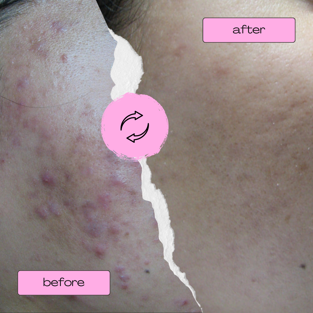Face Reality Before & After (1).png