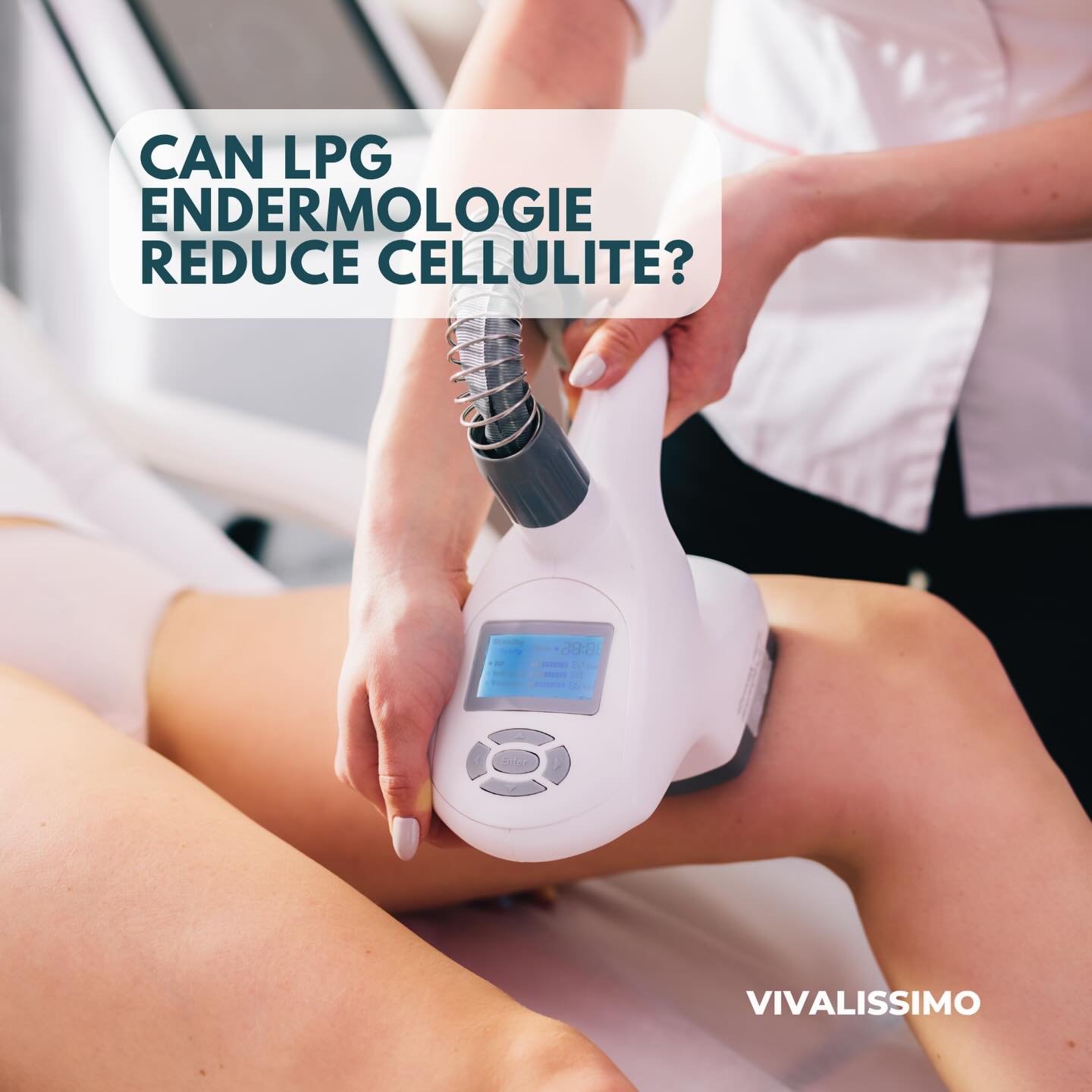 Even with a healthy diet and regular exercise, stubborn cellulite can persist. This non-invasive, non-surgical treatment helps smooth the skin and boost circulation&mdash;improving tone and texture over time. Link in Bio. #lpg #cellulitereduction #sk
