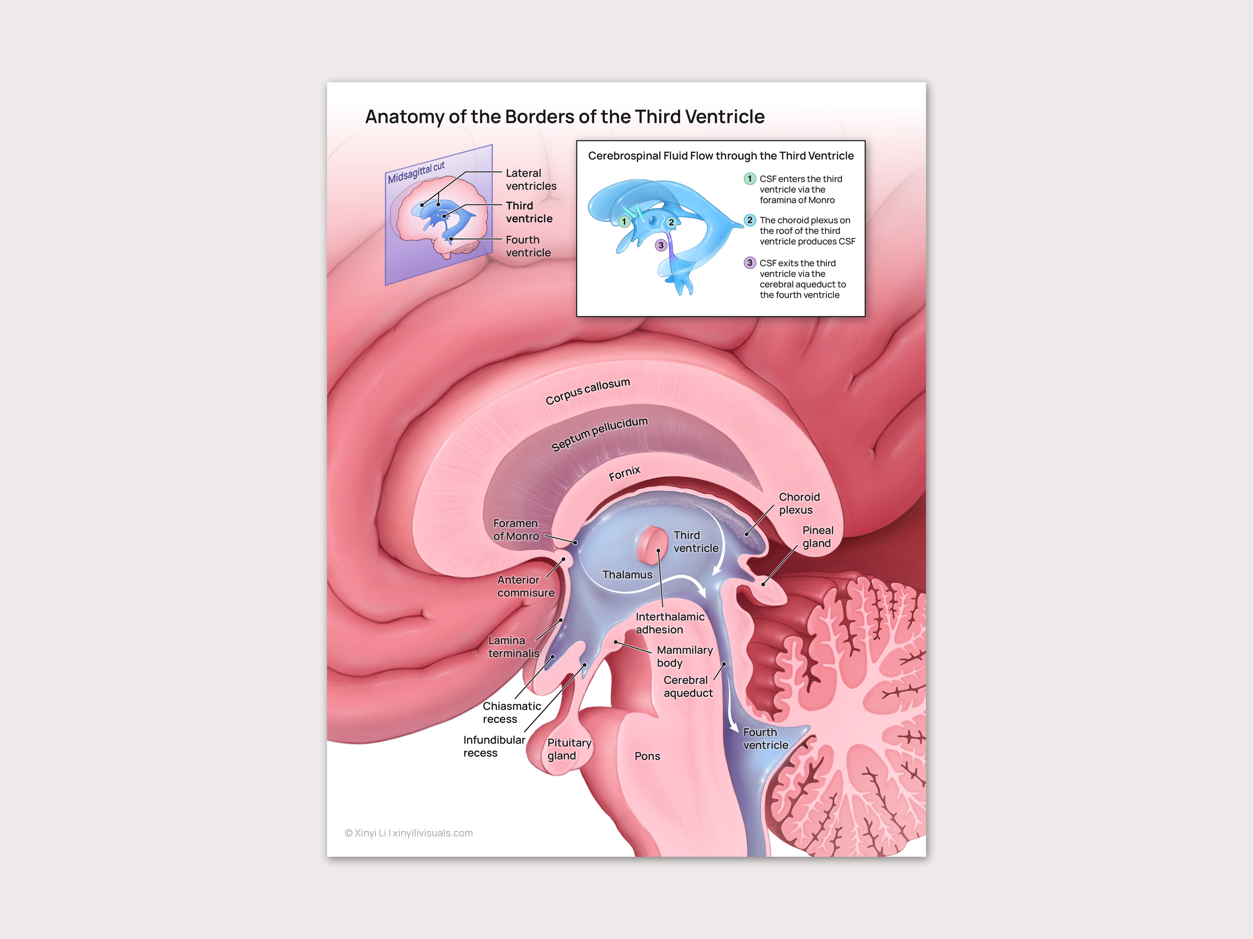 Anatomy of the Third Ventricle