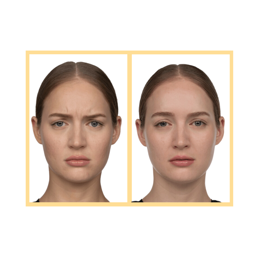 Jeuveau® Injections in Aurora, IL and Downtown Batavia, IL