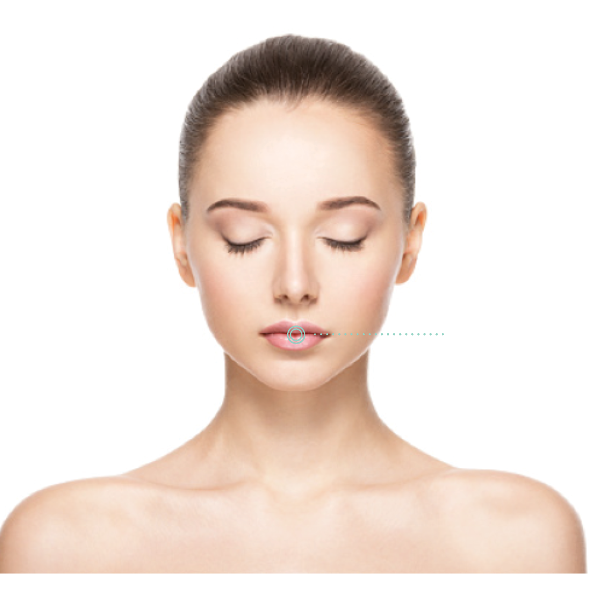 Revanesse® Lips™+ Lip Injections in Aurora, IL and Downtown Batavia, IL