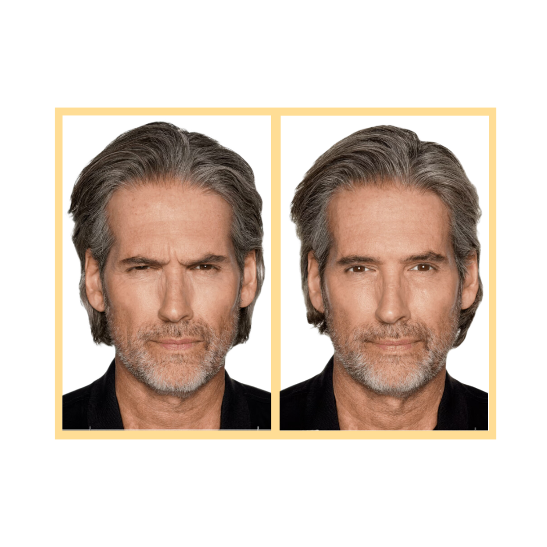 Daxxify® Injections in Aurora, IL and Downtown Batavia, IL