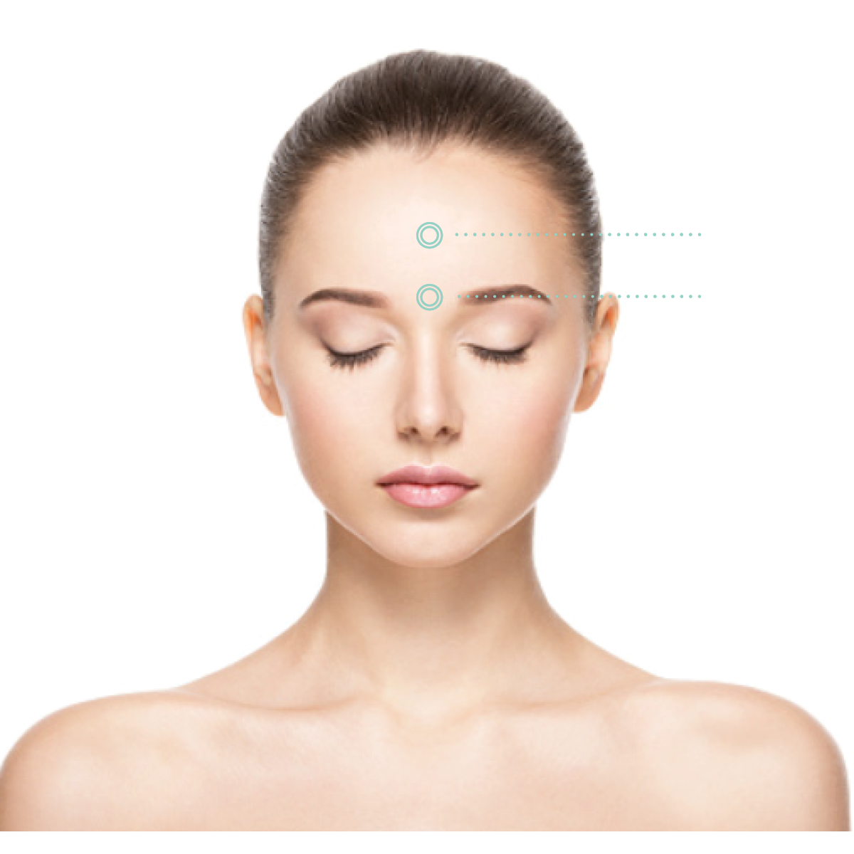 Jeuveau® Forehead in Aurora, IL and Downtown Batavia, IL
