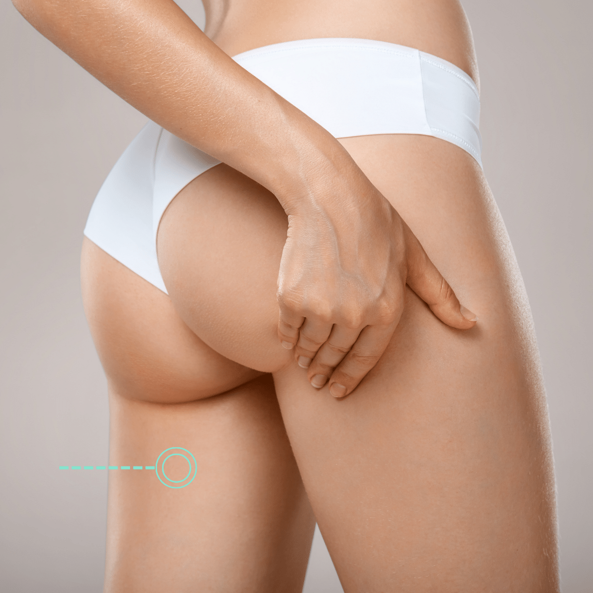 Back Thigh Body Sculpting in Batavia, IL