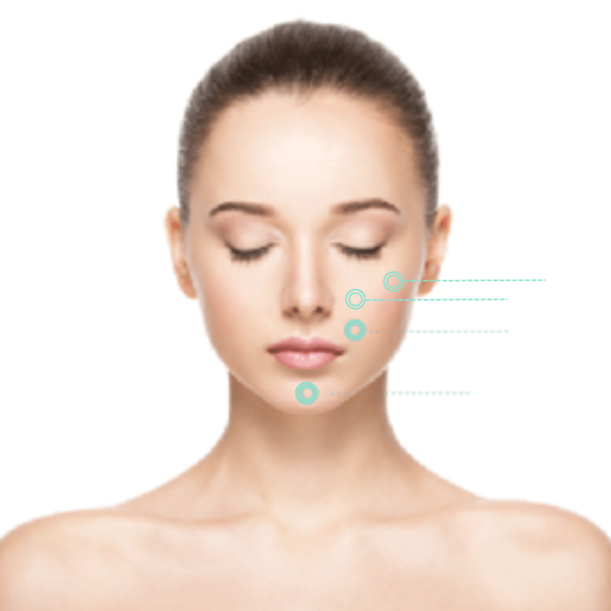 Sculptra®  in Aurora, IL and Downtown Batavia, IL