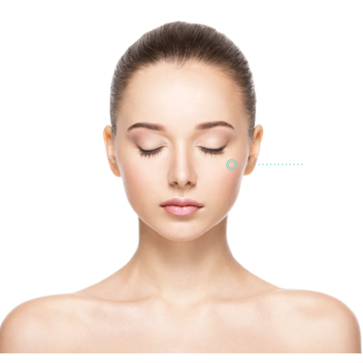 Cheeks Revanesse Versa Dermal Filler Med Spa Treatment