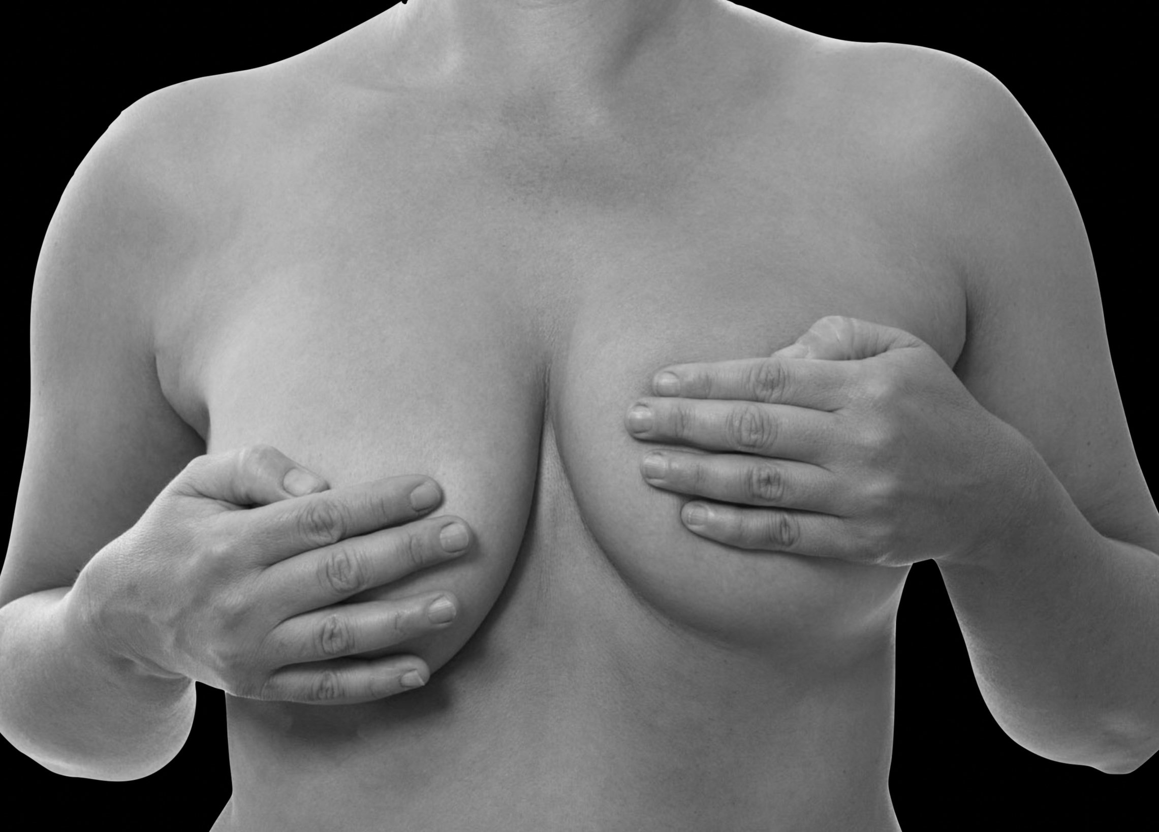 Borstrevisie door dr. Karl Waked na borstvergroting, borstverkleining, borstlift of borstreconstructie