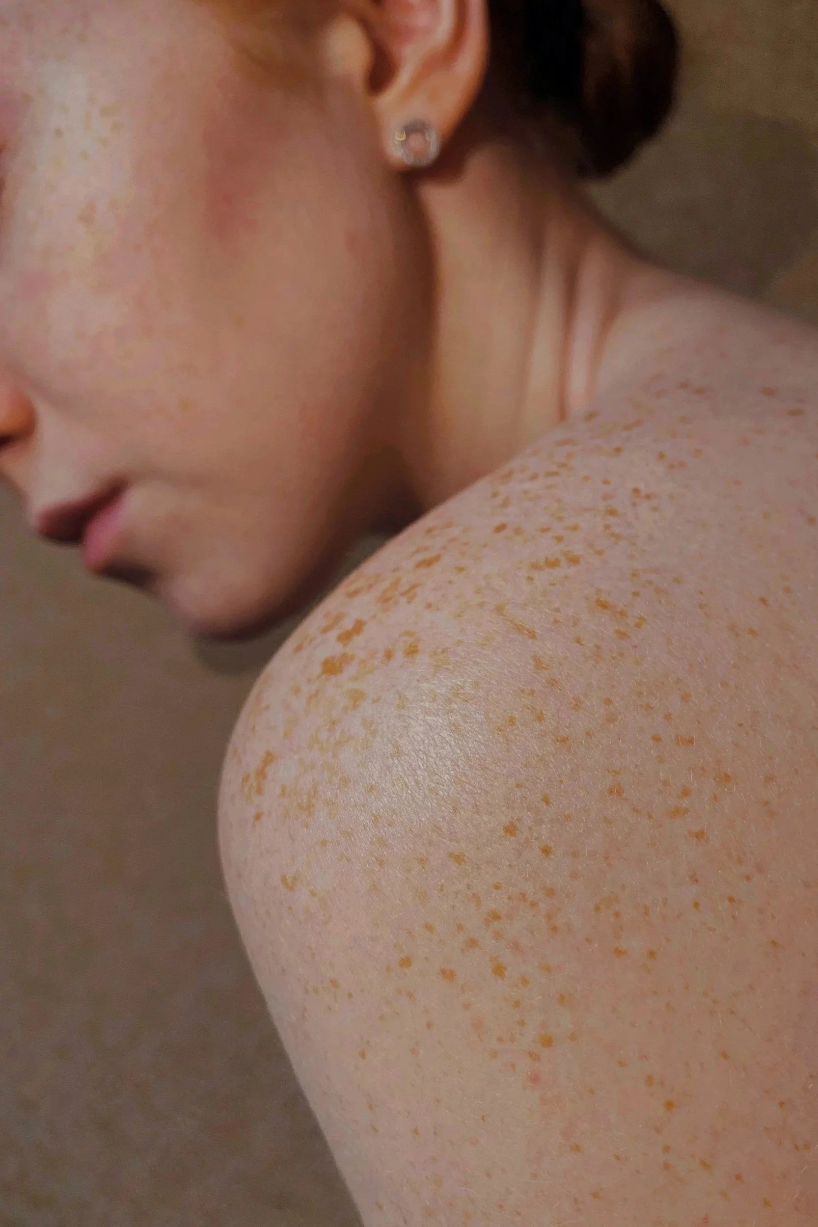 functional medicine for acne and skin conditions in western Wisconsin and twin cities