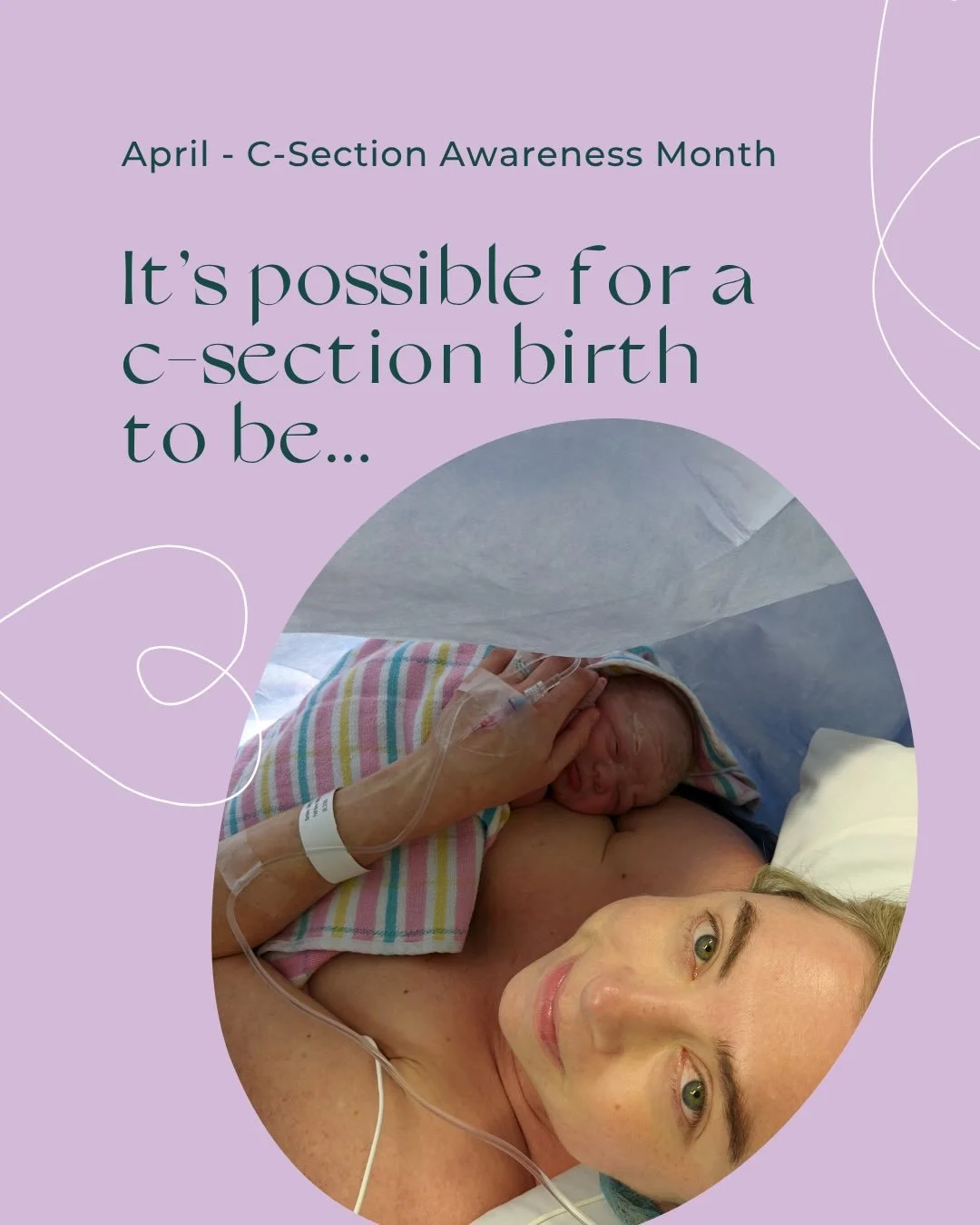 April is C-section Awareness Month, and I&rsquo;ve been reflecting on my own experiences, alongside the birth stories I&rsquo;m so privileged to hear from my clients.

Sometimes, a c-section is planned and can feel empowering, prepared for and deeply