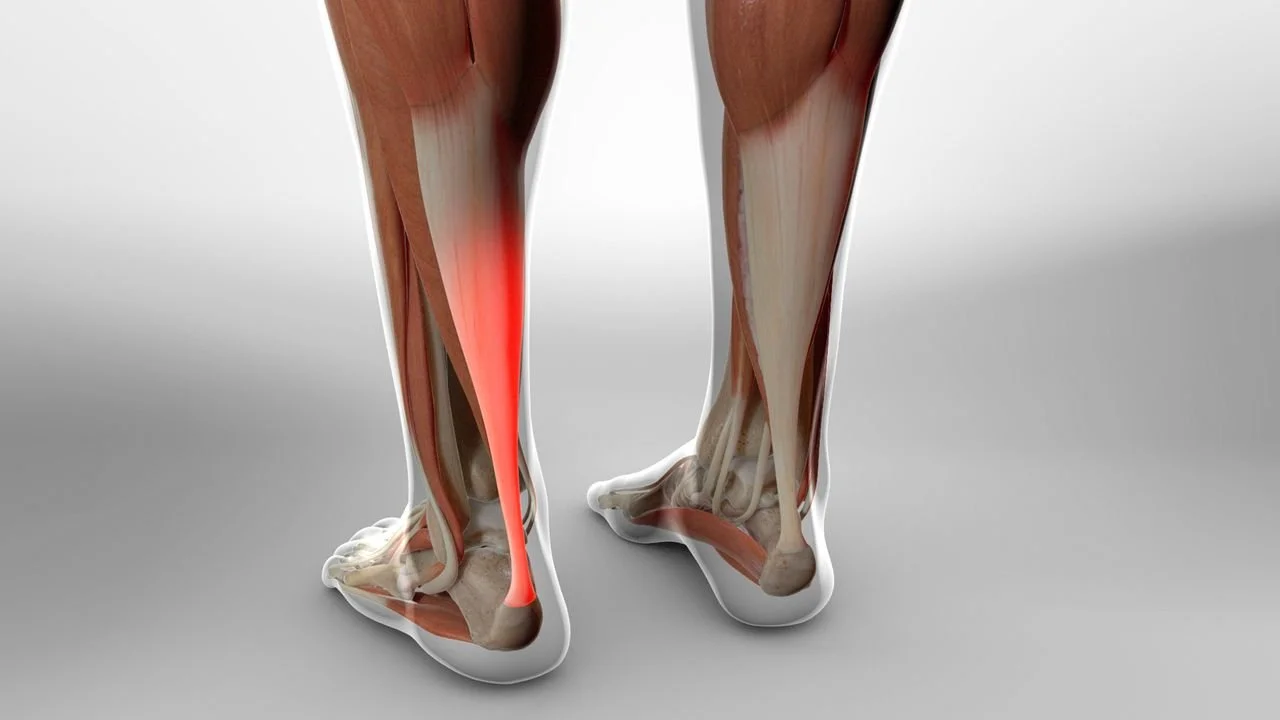 Achilles tendon