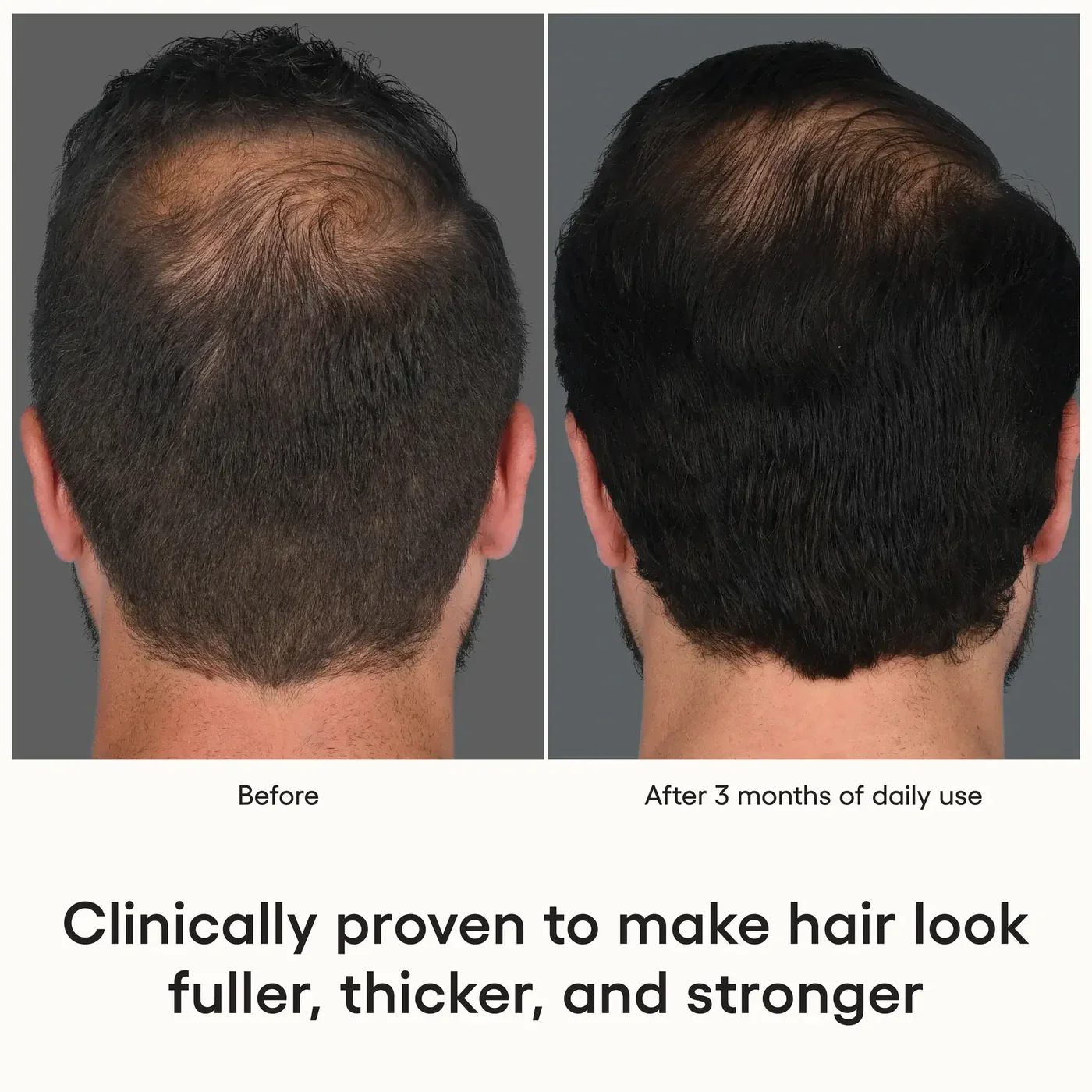 At_Home_Exosomes_for_HAIR_Plated_Hair_Serum-9.webp