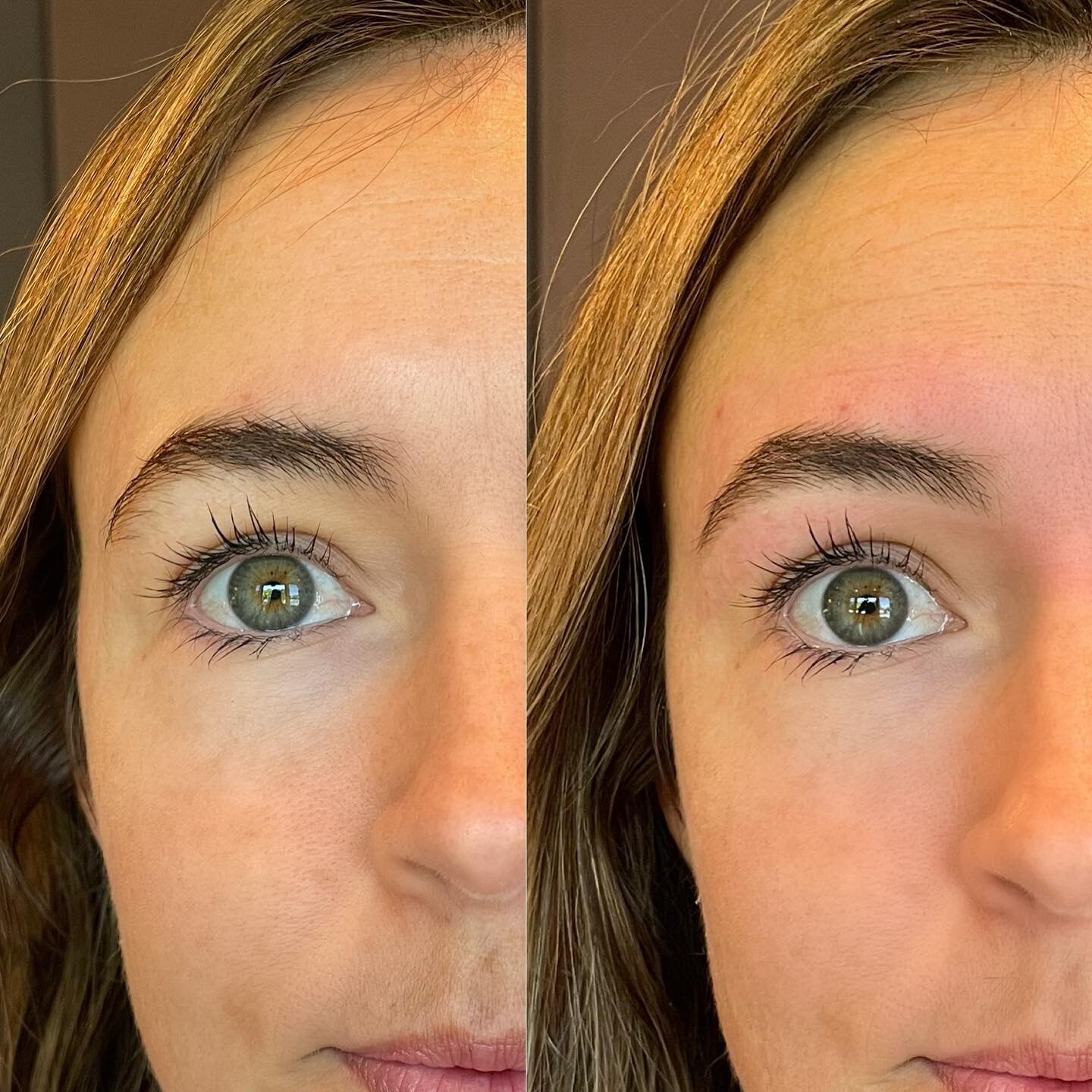 Whether you&rsquo;re starting with lots or little brow, our methods can help you achieve your best natural shape without the need for permanent makeup. Taking just the right hairs makes all the difference on maximizing this beautiful client&rsquo;s b