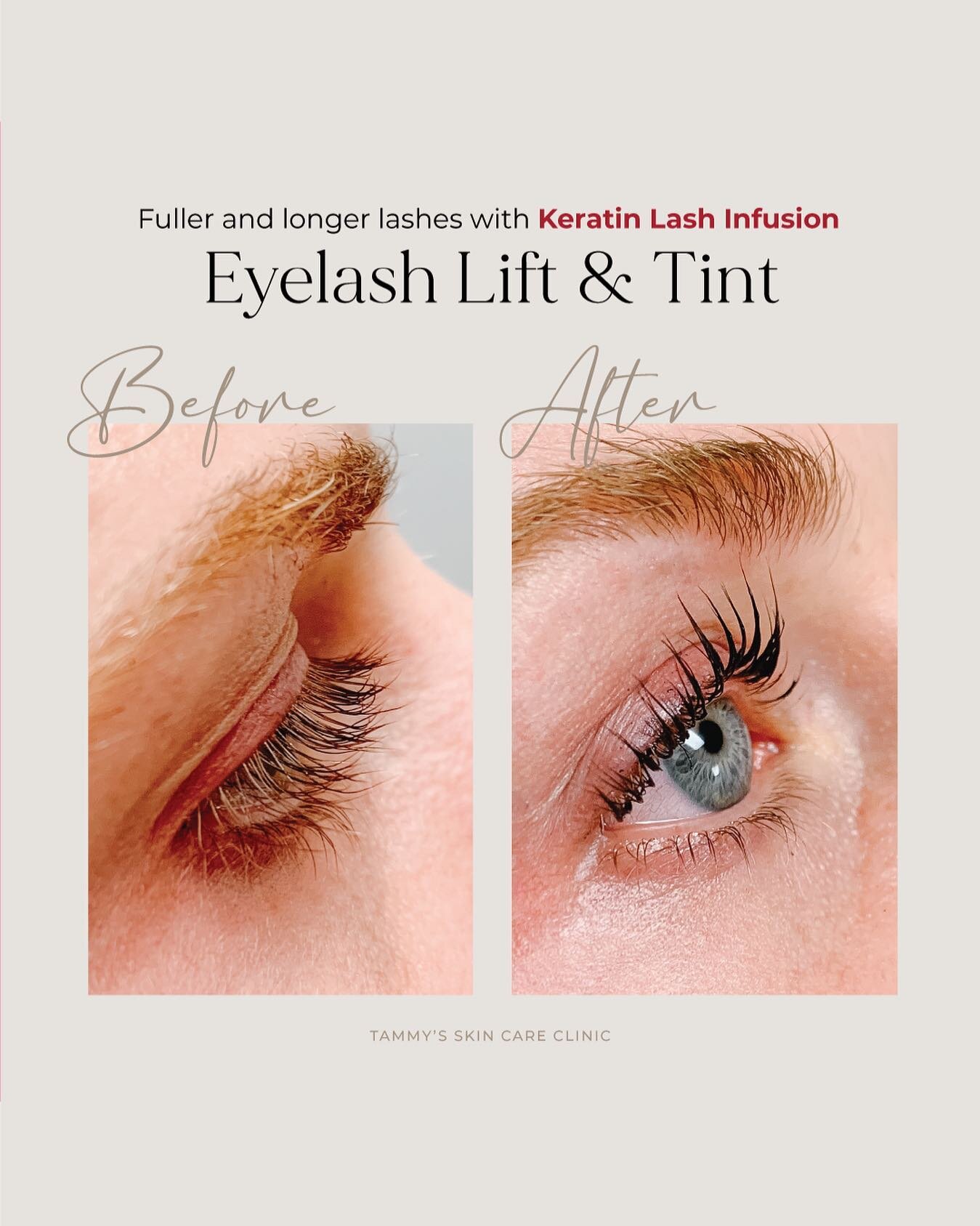 Get fuller and longer lashes with our Keratin Lash Infusion Lift with Tint!
.
Book an appointment today! DM or reach out on our website. Enquire for pricing.
.
.
.
.
.
#tammysskincareclinic #eyelashes #longlashes #fullerlashes #keratinlashinfusion #k