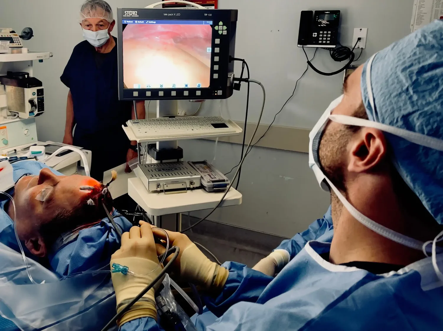 Dr. Sturgill performing an endoscopic brow lift using specialized instruments and a tiny camera through small hidden incisions