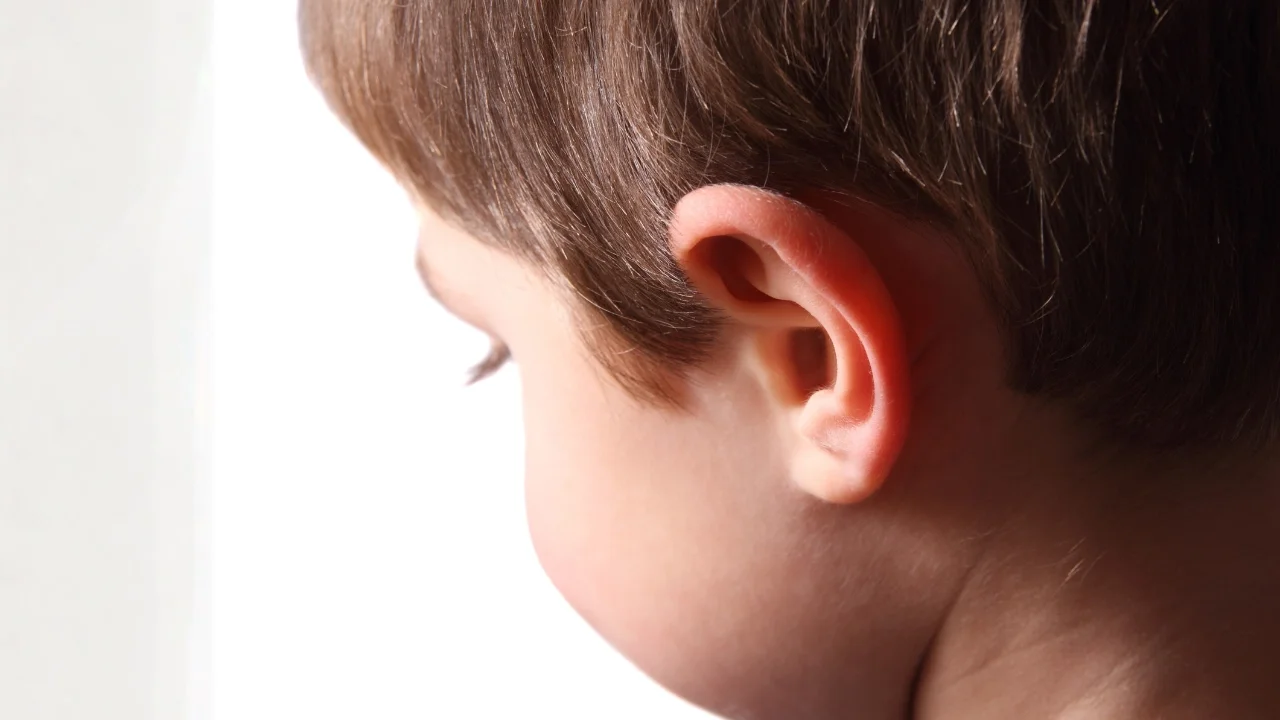 Pediatric otoplasty candidate—child with prominent ears