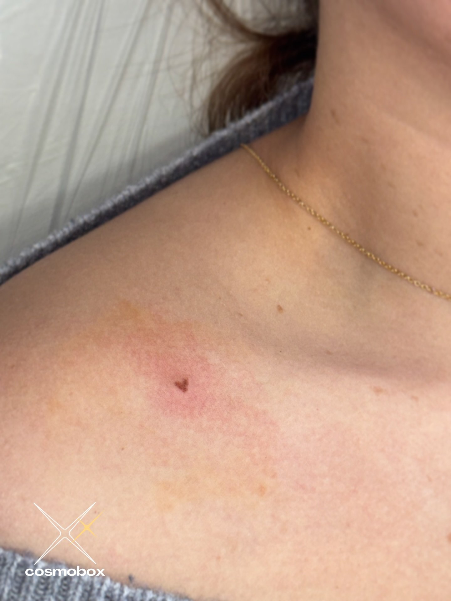 So dainty and cute! A tiny detail with a lot of heart ❤️
This delicate, hand-poked beauty mark  tattoo adds the sweetest touch to her shoulder.  This tiny heart was in addition to her freckle tattoo - stay tuned to see those results!

............

&