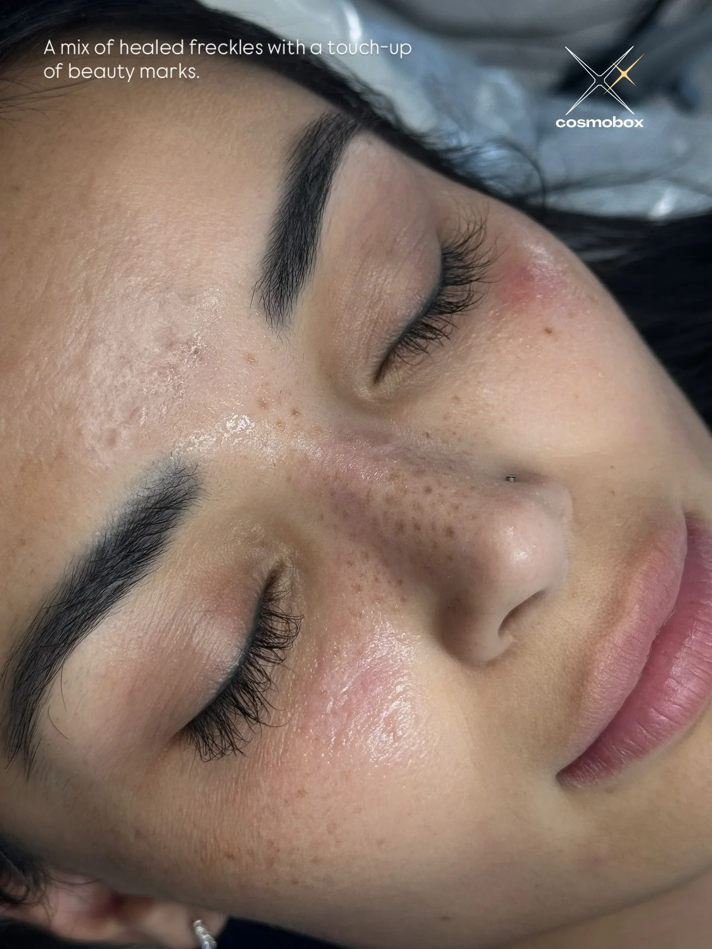 Healed &amp; Touched-Up Freckles

At COSMOBOX, freckles and beauty marks are created with the hand-poked method&mdash;a gentle, precise technique that heals into the most natural results. Hand-poked freckles fade softly, which means they can be touch