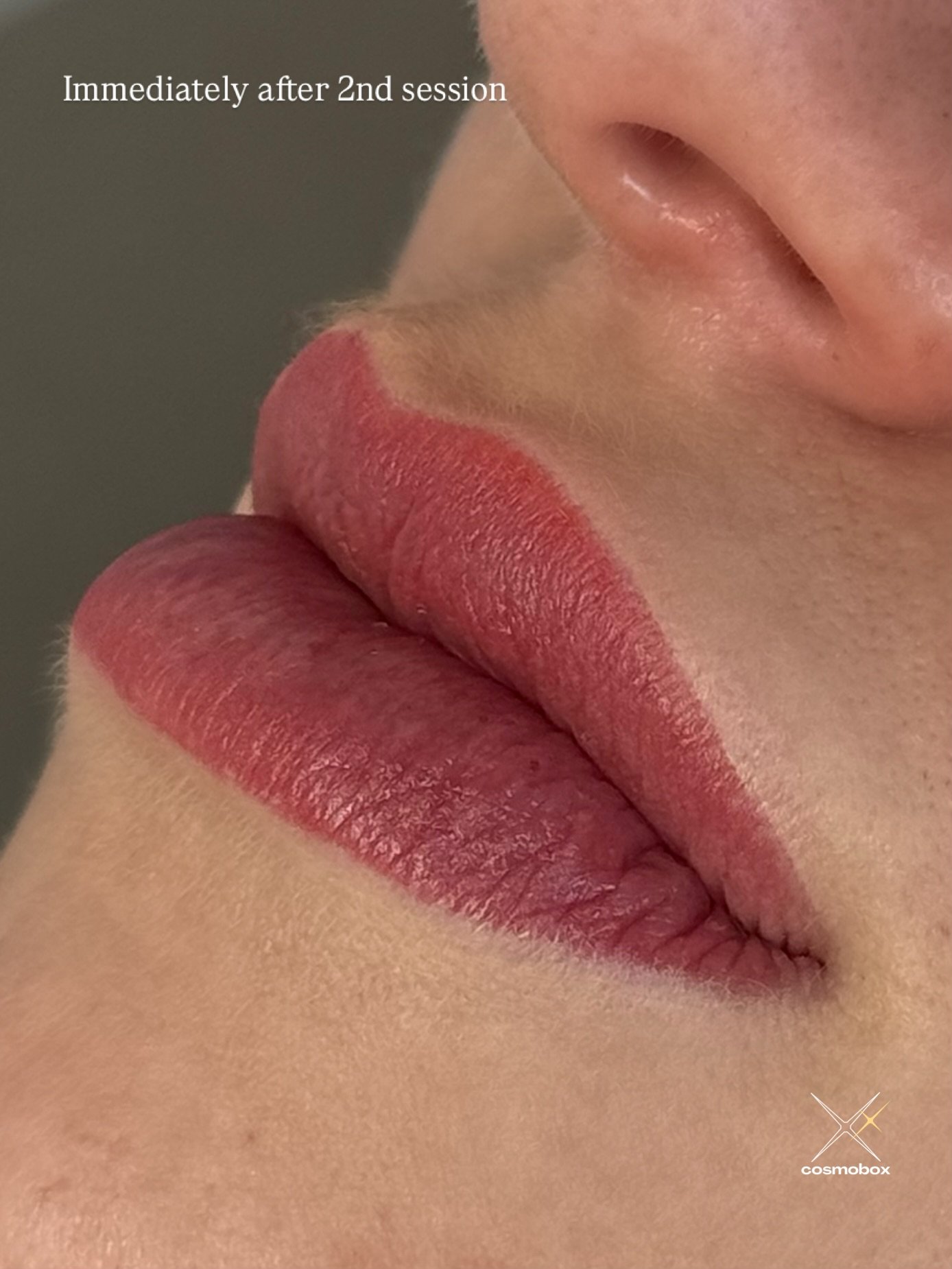 Lip blushing is a process&mdash;and this set shows exactly why.

Slide 1: Immediately after her 2nd session
Slide 2: Healed results from her 1st session compared to her natural lip color
Slide 3: Fresh after the 2nd session, finished with gloss

Her 