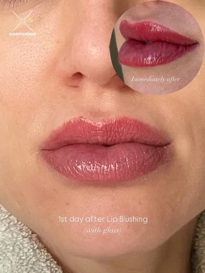 Day 1 after 2nd session Lip Blushing ✨
(Shown with gloss, bare lips)

Swipe to see:
➡️ Day 1 healed (bare + gloss)
➡️ Immediately after

These photos are taken the day after my client&rsquo;s second lip blush session &mdash; and as you can see:
✔️ Mi