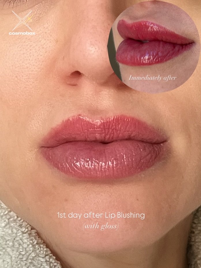 Day 1 after 2nd session Lip Blushing ✨
(Shown with gloss, bare lips)

Swipe to see:
➡️ Day 1 healed (bare + gloss)
➡️ Immediately after

These photos are taken the day after my client&rsquo;s second lip blush session &mdash; and as you can see:
✔️ Mi