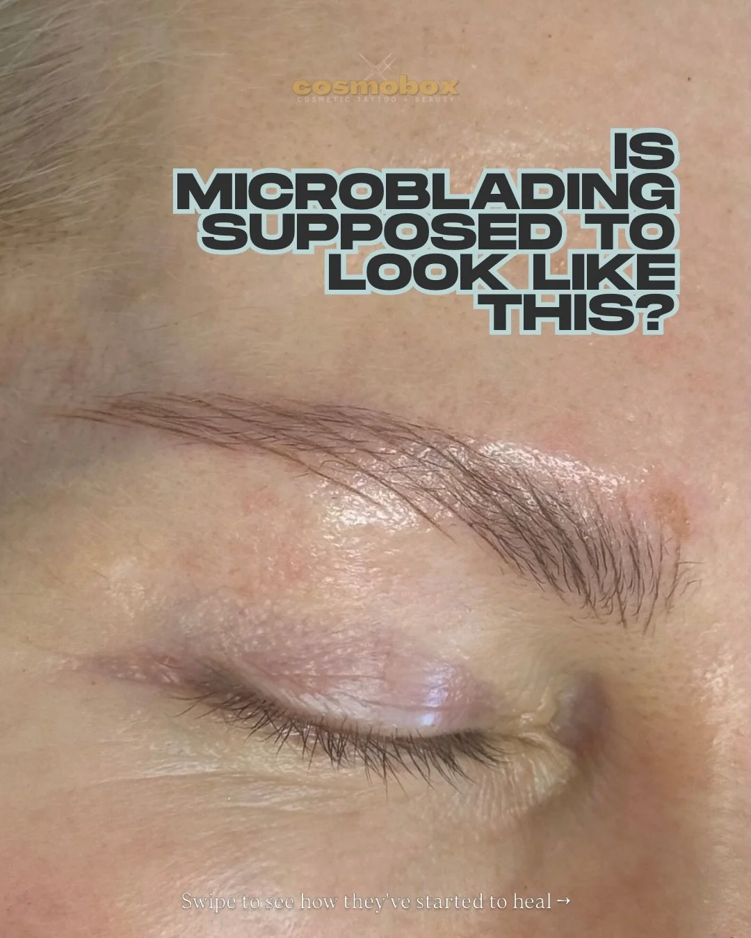 Brows that look bold today&hellip; so they can look natural for years. 🔥

Swipe to see immediately after vs. Day 7 healing.

Right after microblading, strokes can appear more dramatic and defined. But when the correct depth, pigment choice, and stro