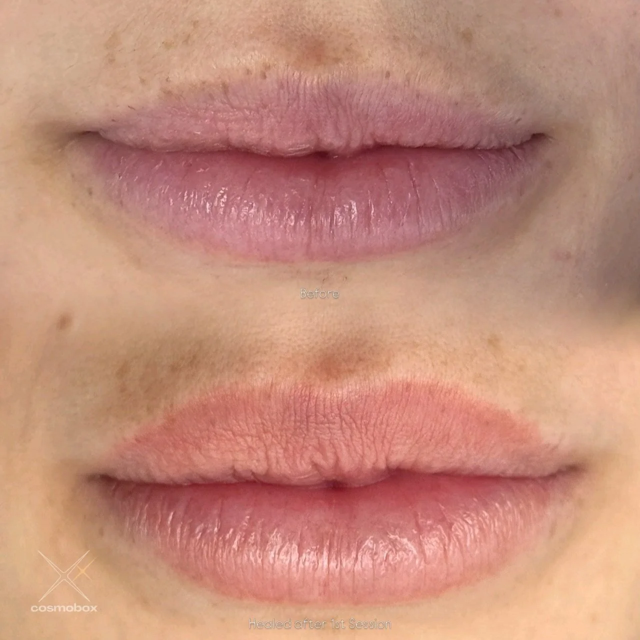 More shape. More balance. No filler. 👄✨

This transformation is fully healed after just one session of lip blushing&mdash;and the difference is all in the borders.

Her natural lip color was very pale along the edges (especially the top lip), which 