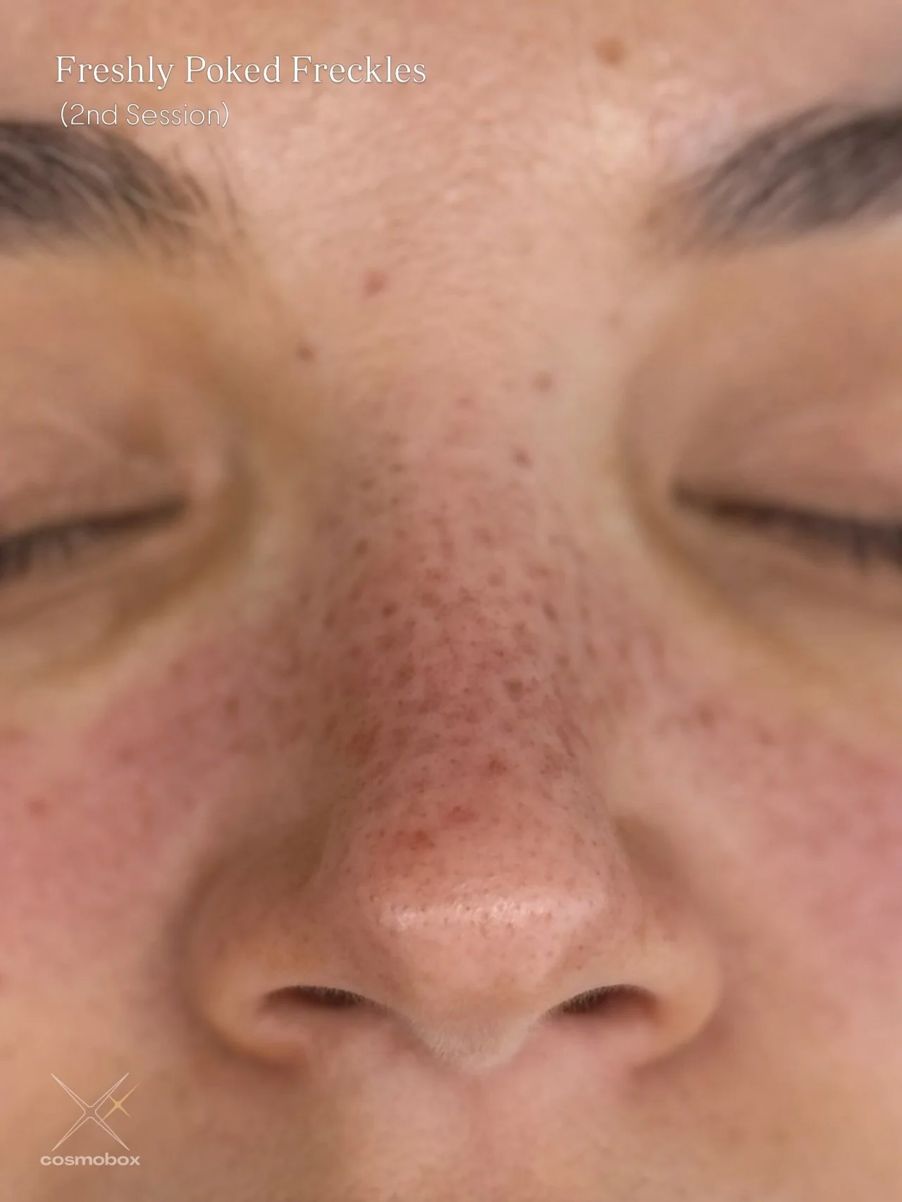 Had the pleasure of creating custom freckles for Oakland-based artist @essie.tattoos 🤎✨

These are from her 2nd session&mdash;where we built onto her healed freckles to create a fuller, more seamless blend. This is where the magic really happens&hel