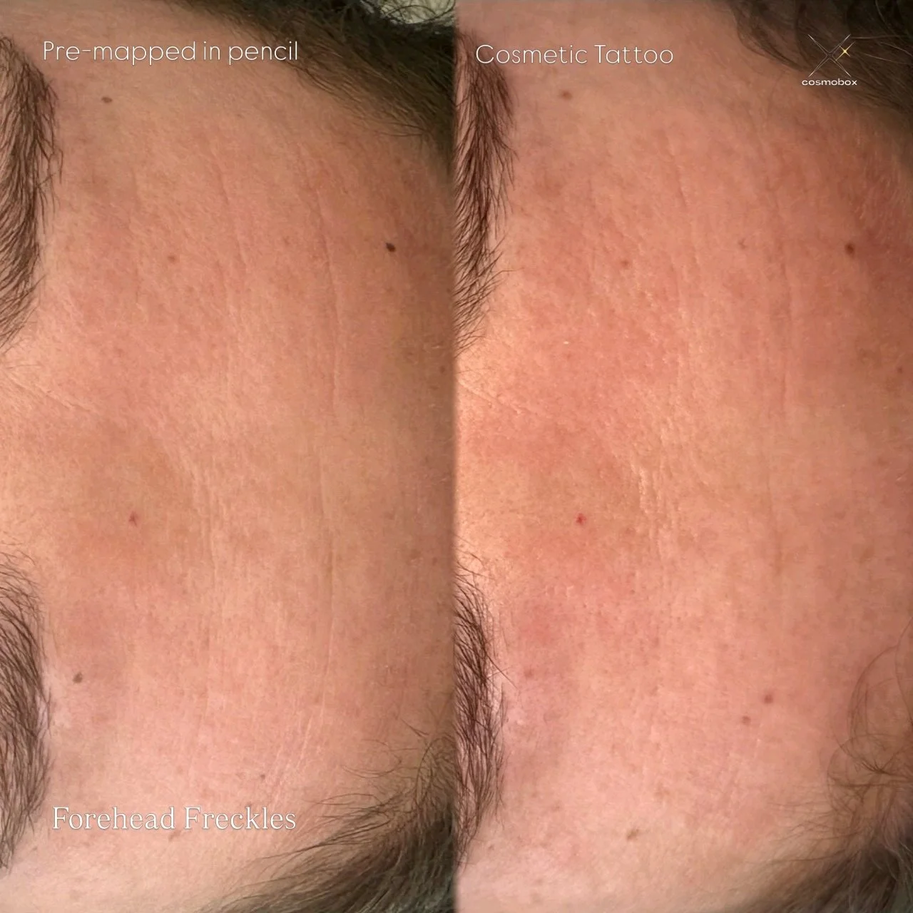 From mapping to skin ✨

What you&rsquo;re seeing:
&bull; Pre-mapped placement (in pencil)
&bull; Freshly hand-poked freckles, softly tattooed in natural tones

............

Del mapeo a la piel ✨

Lo que est&aacute;s viendo:
&bull; Mapeo previo (en l