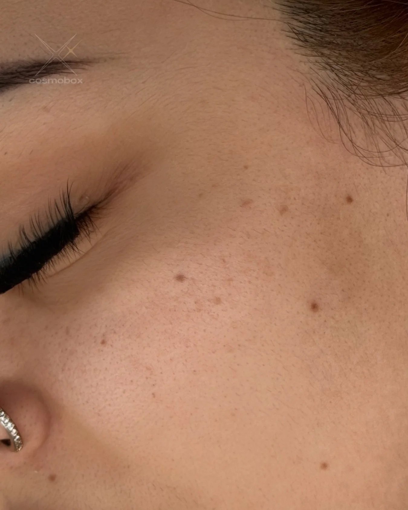 When every little freckle ... is a tattoo ☺️
(Healed after 2 sessions/Curado despu&eacute;s de 2 sesiones)

#cosmetictattoo #freckletattoo #pmu #handpoked #beautymark