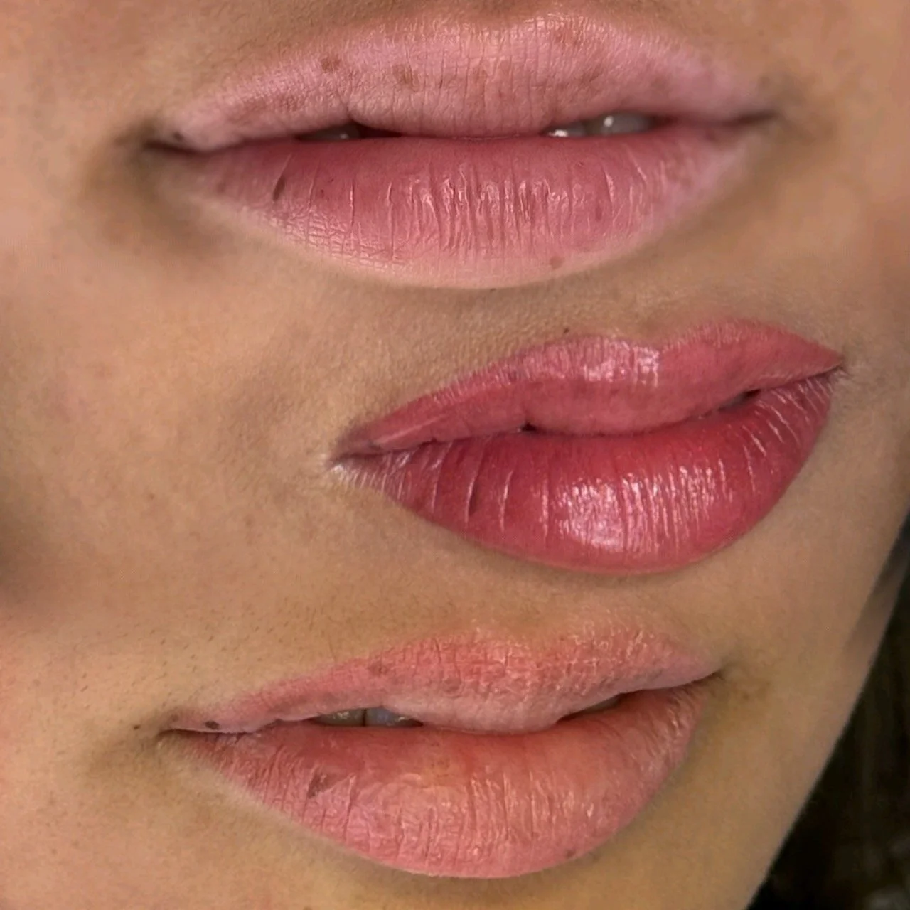 Before, immediately after, and Healed results of 1 session of lip blushing.