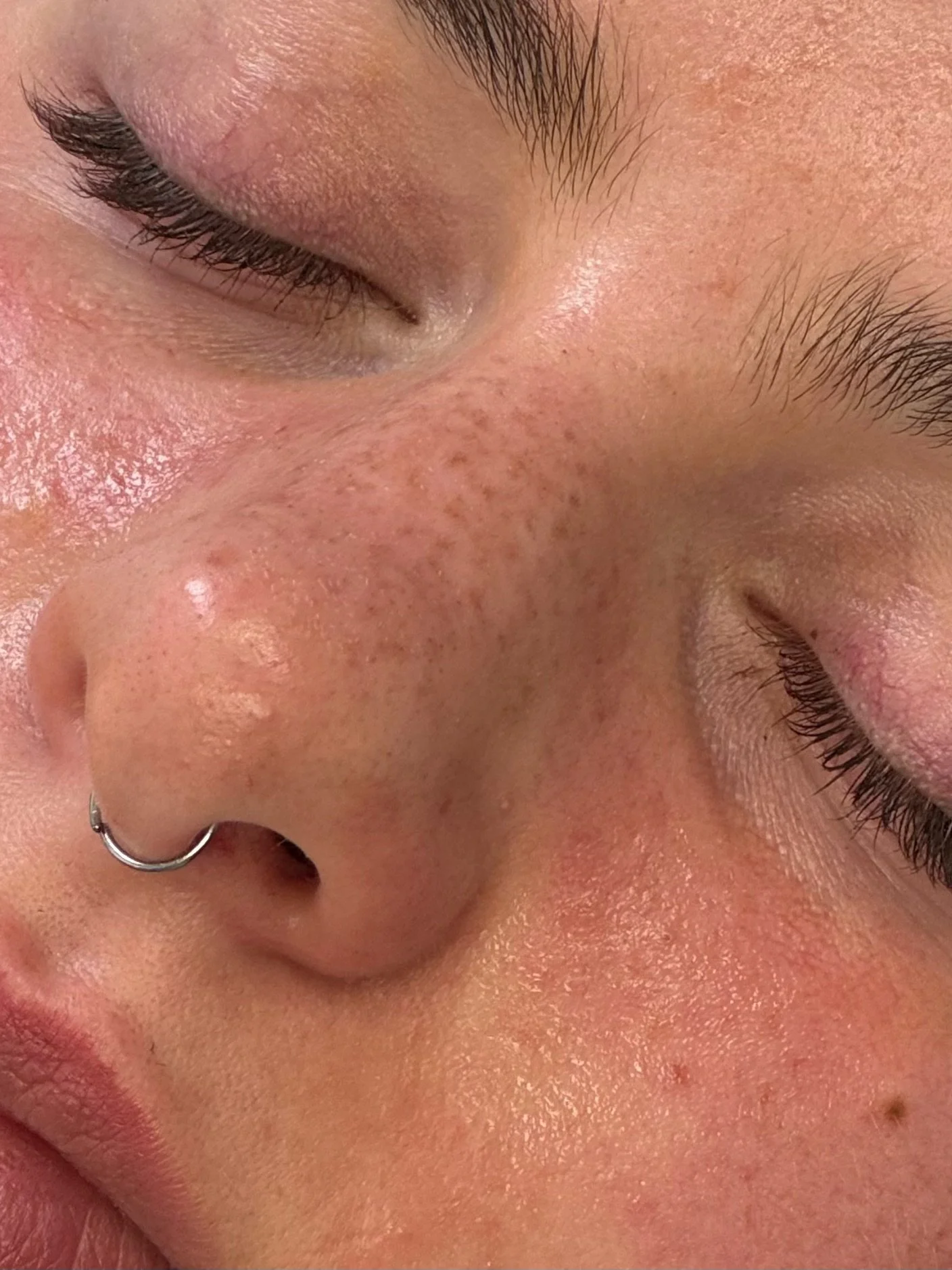 Healed freckles + beauty mark tattoos