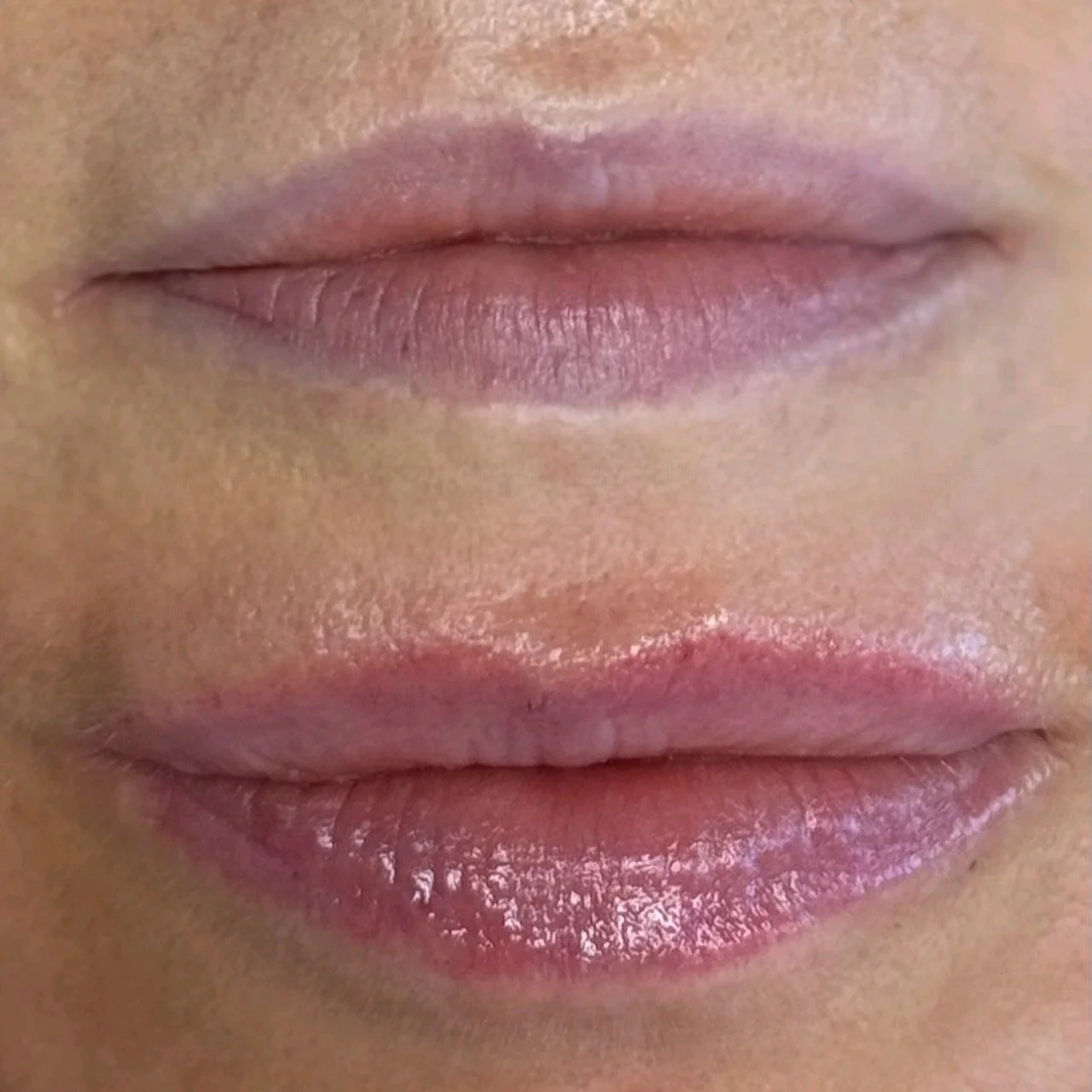 Before and (healed) After, lip blushing over heavy scarring along borders of the lip line.