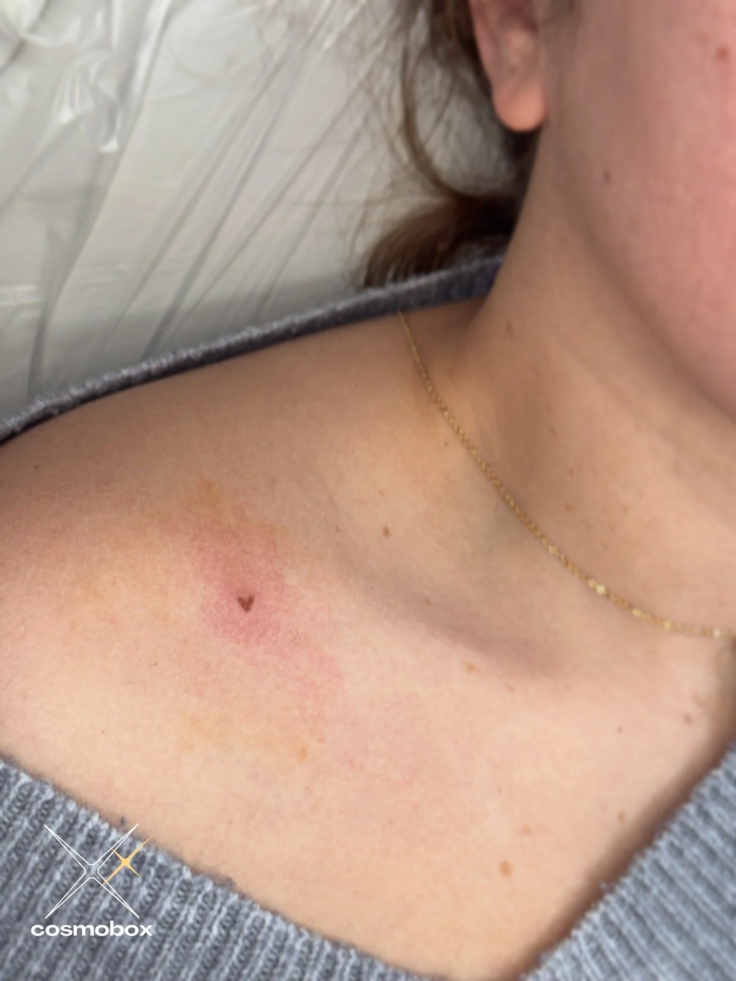 Heart-shaped beauty mark tattoo.
