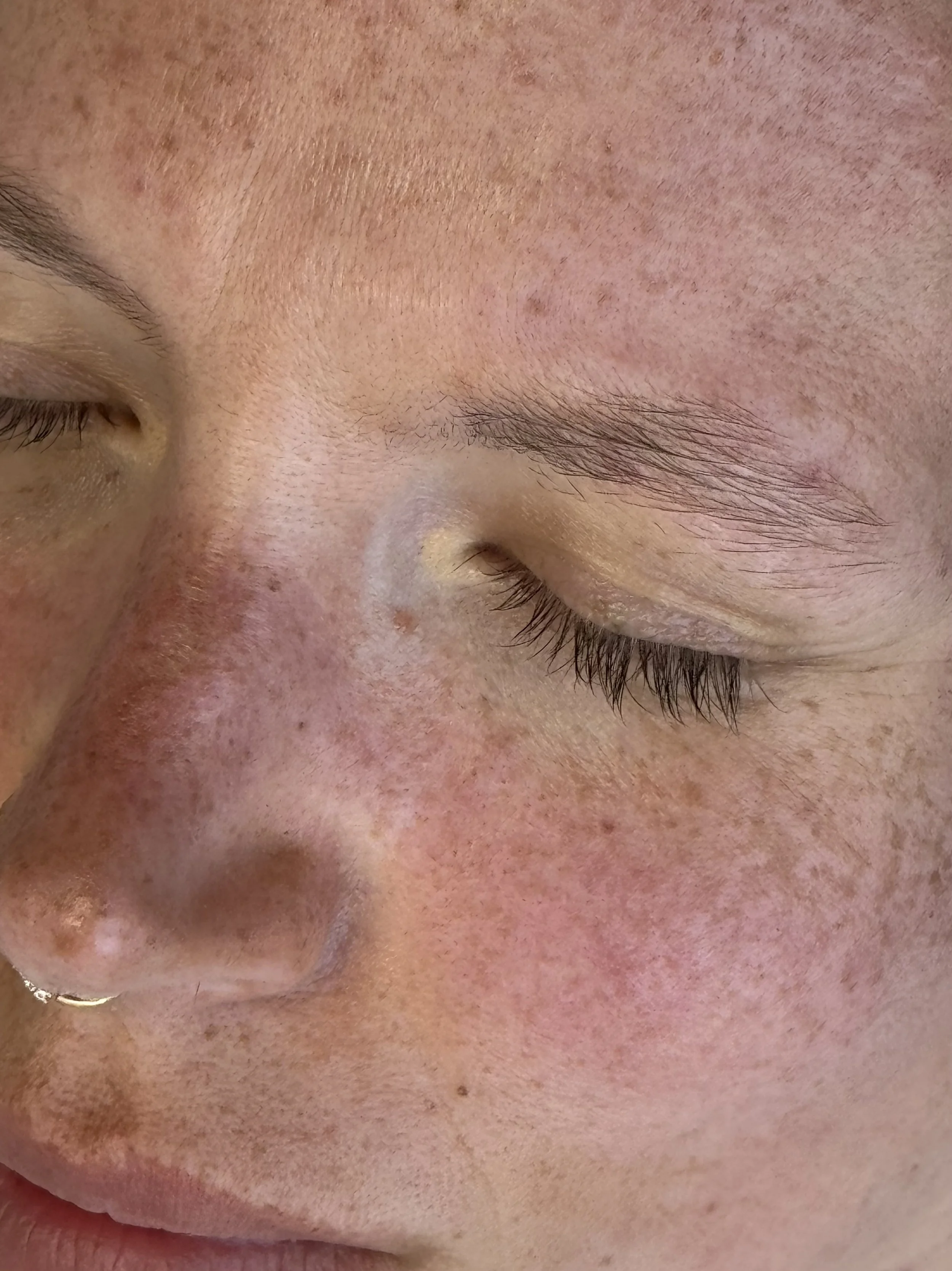 A gorgeous mix of tattooed and natural freckles. (1 session)
