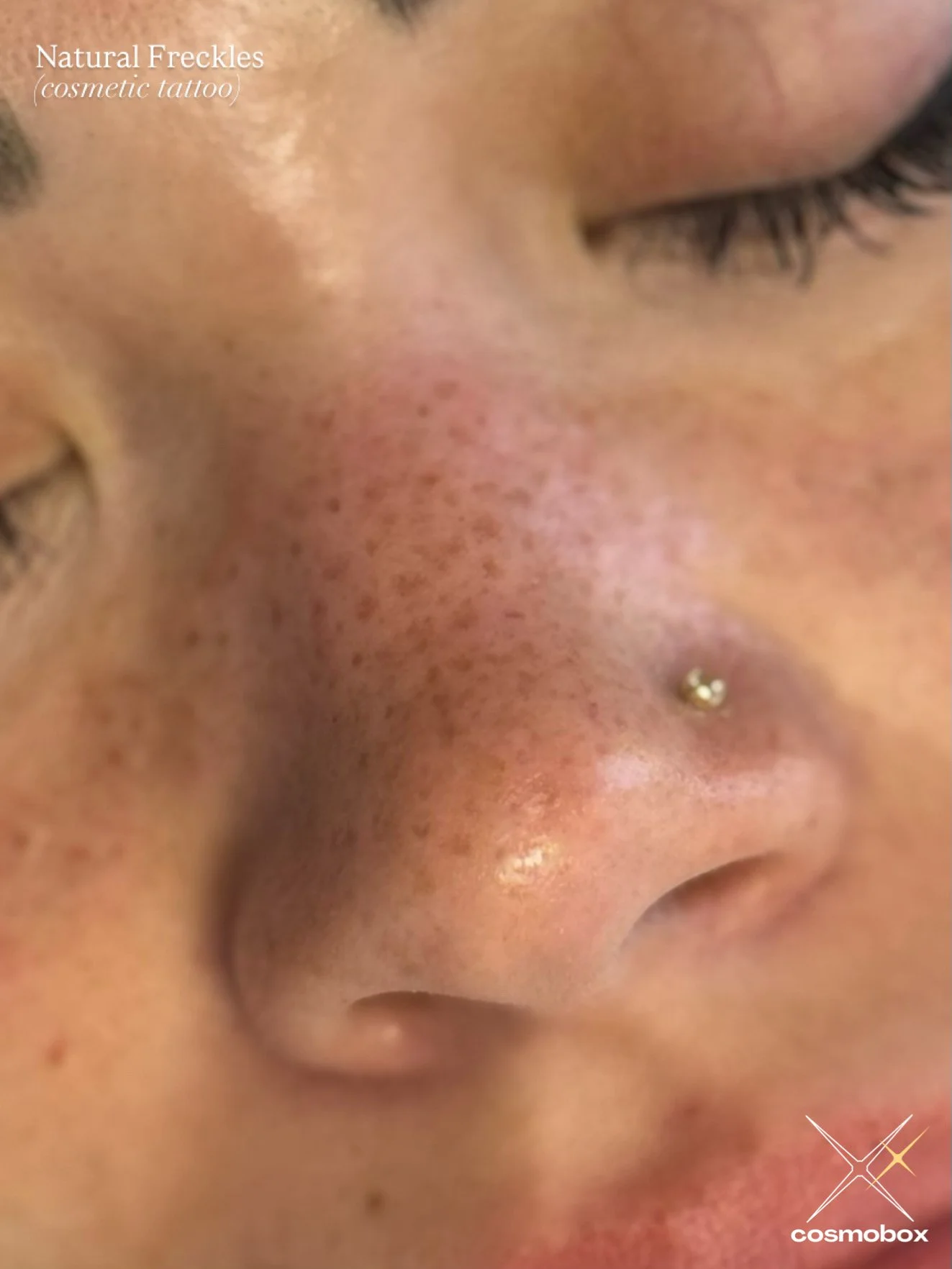 The most natural set of freckles.