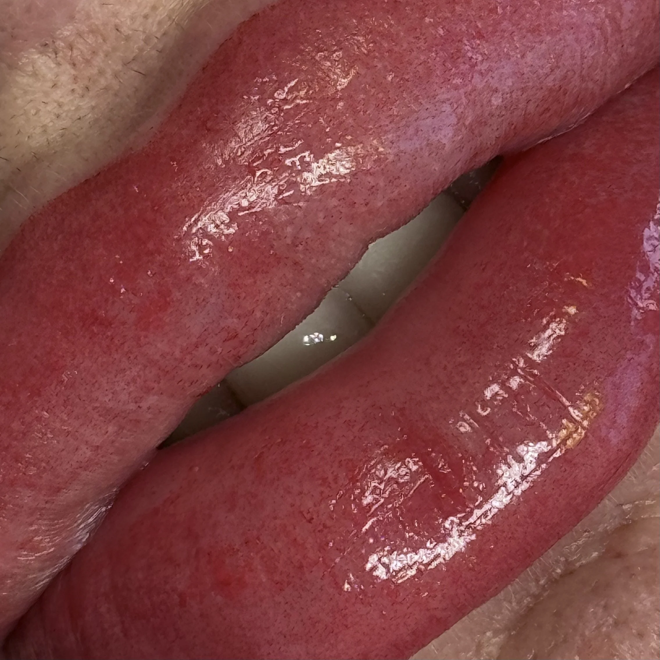 Lip Blushing results.