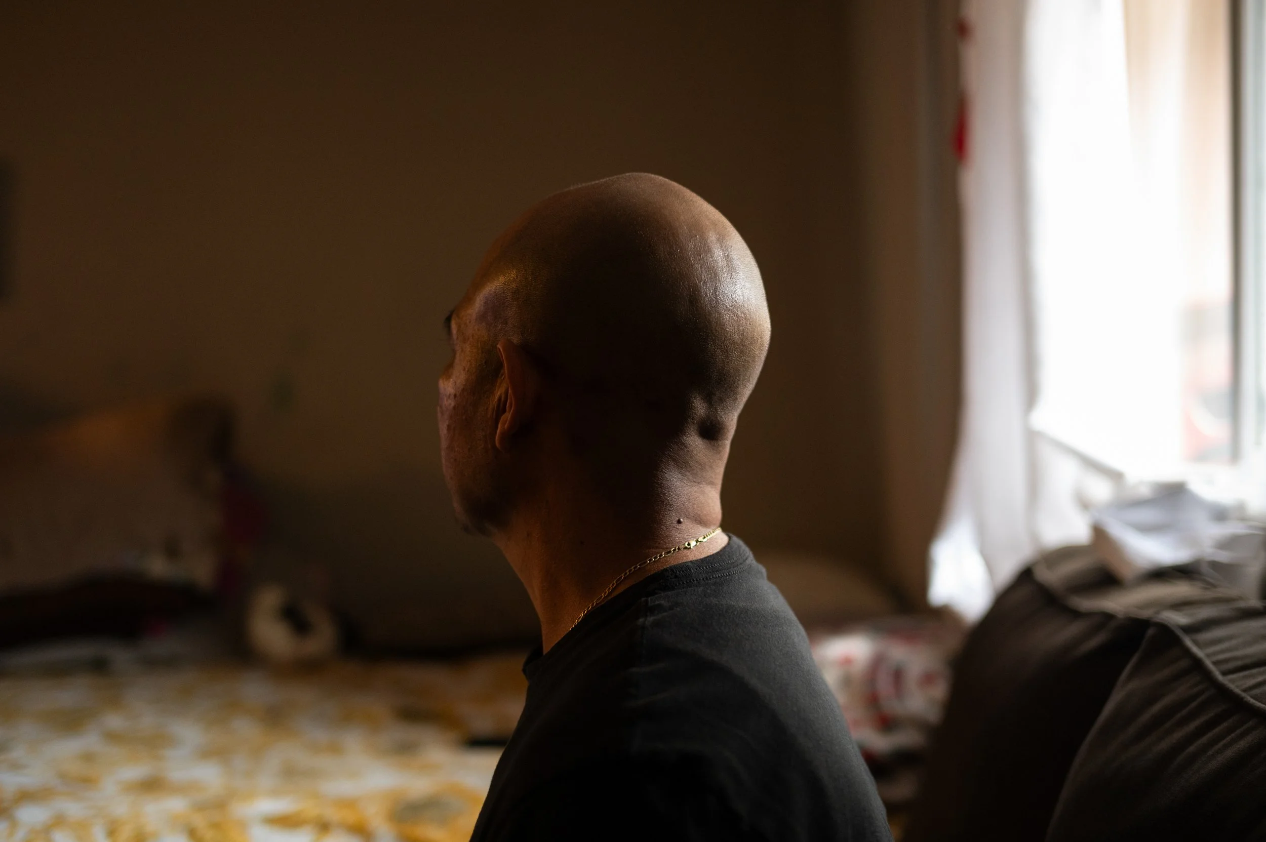  Oscar received a double lung transplant after being diagnosed with silicosis, an incurable occupational lung disease. It has rapidly become a public health crisis among stone fabrication workers cutting engineered stone.  Los Angeles, CA, USA (1/24/