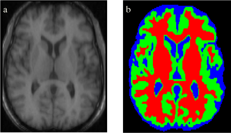 Image+Segmentation+DDD