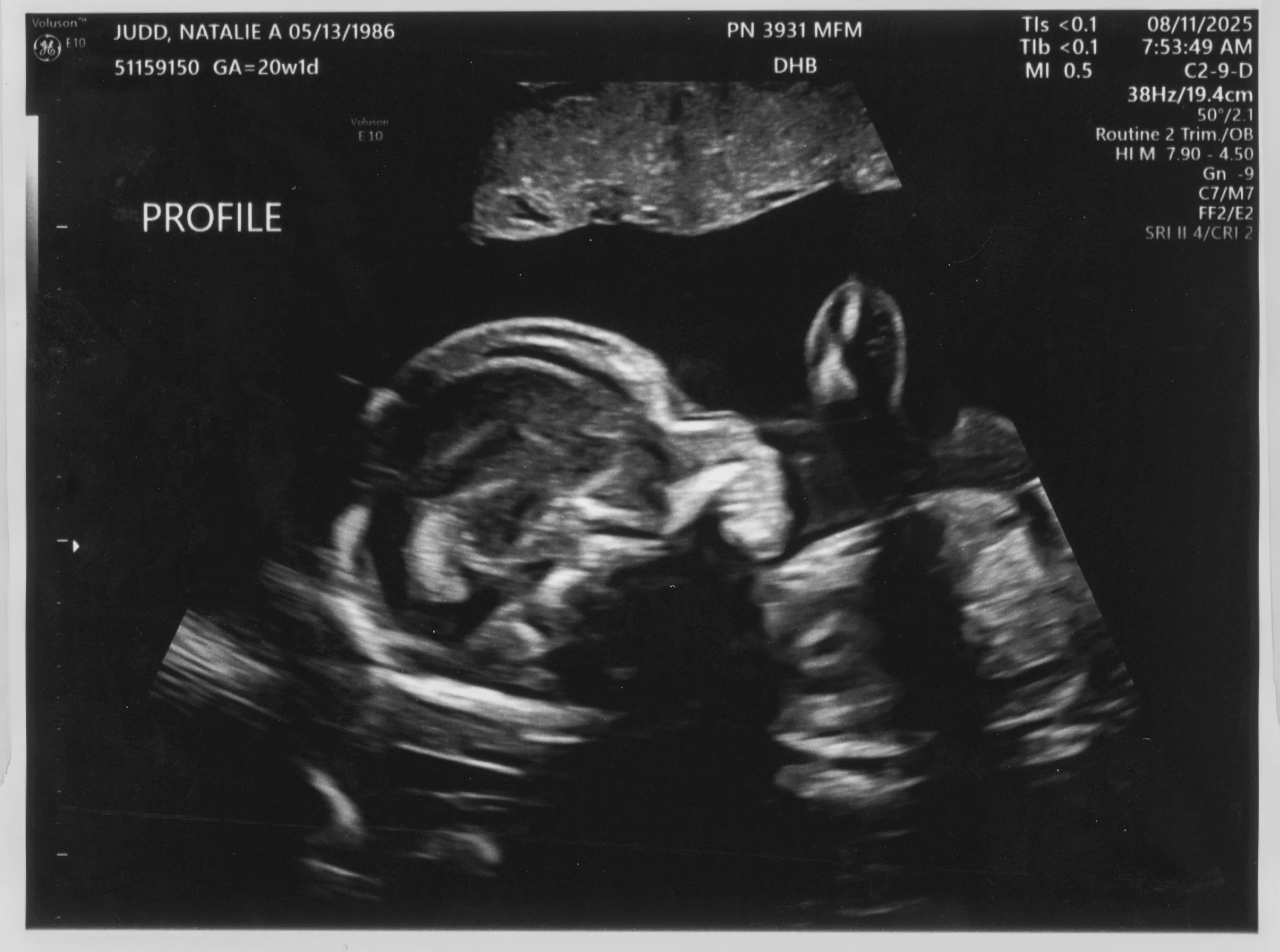UltraSoundsScans_08-11-2025_003-RT1.jpg