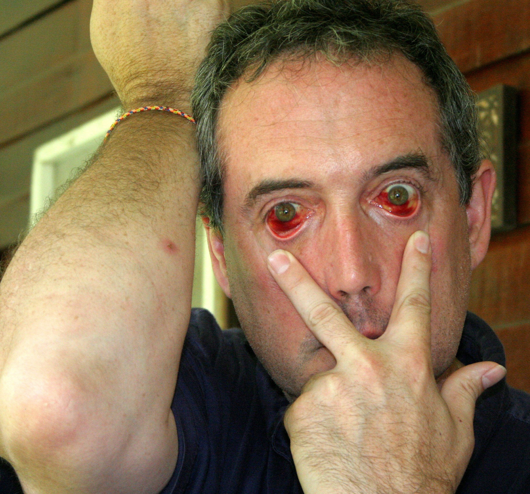 KINABATANGAN RIVER BORNEO - COKE'S SPIDER BITE TERMINATOR LOOK.JPG