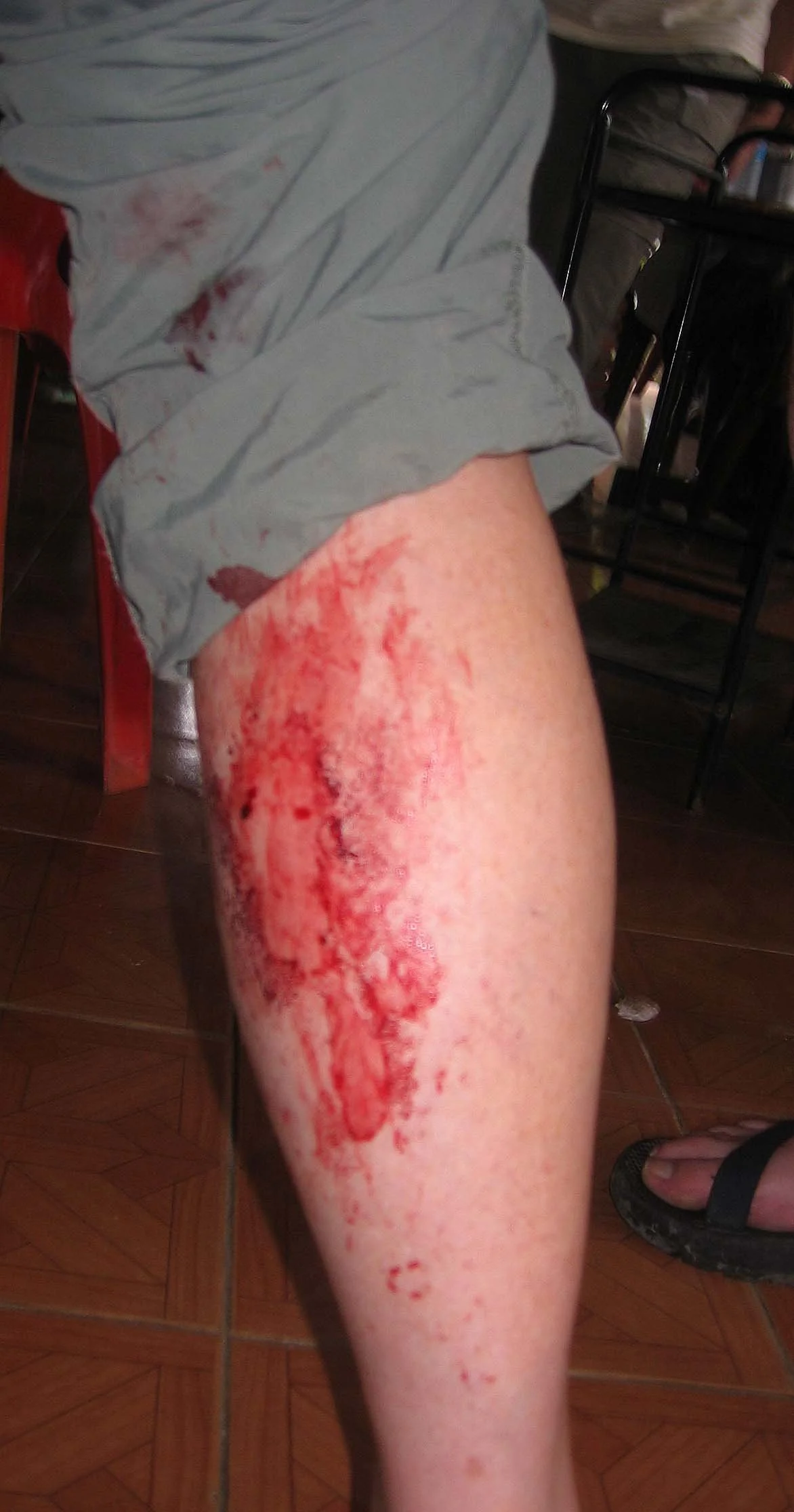 Leeches in the wet season are never fun.