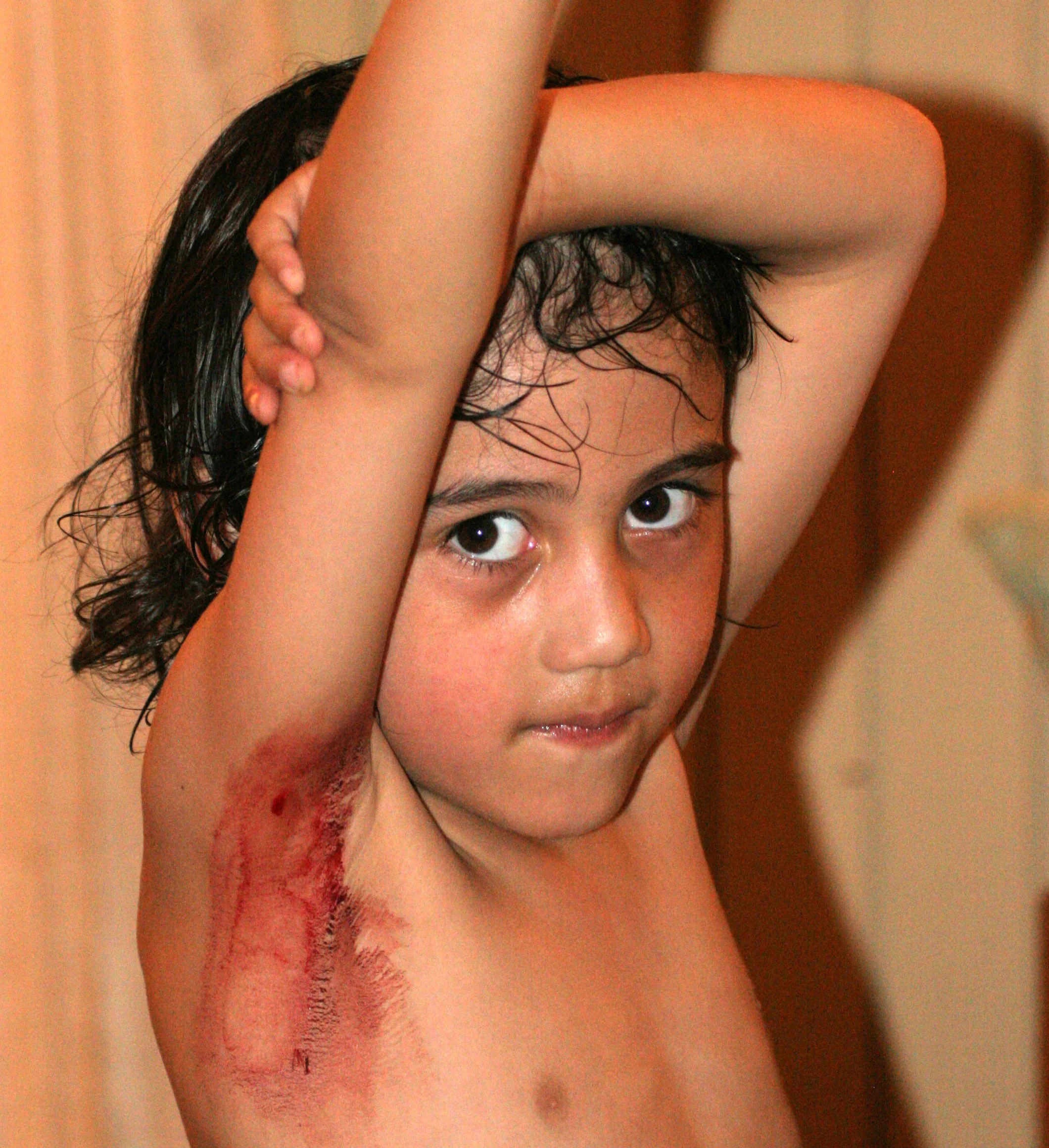 DANUM VALLEY BORNEO - LEECH WOUNDS ON COKIE.JPG