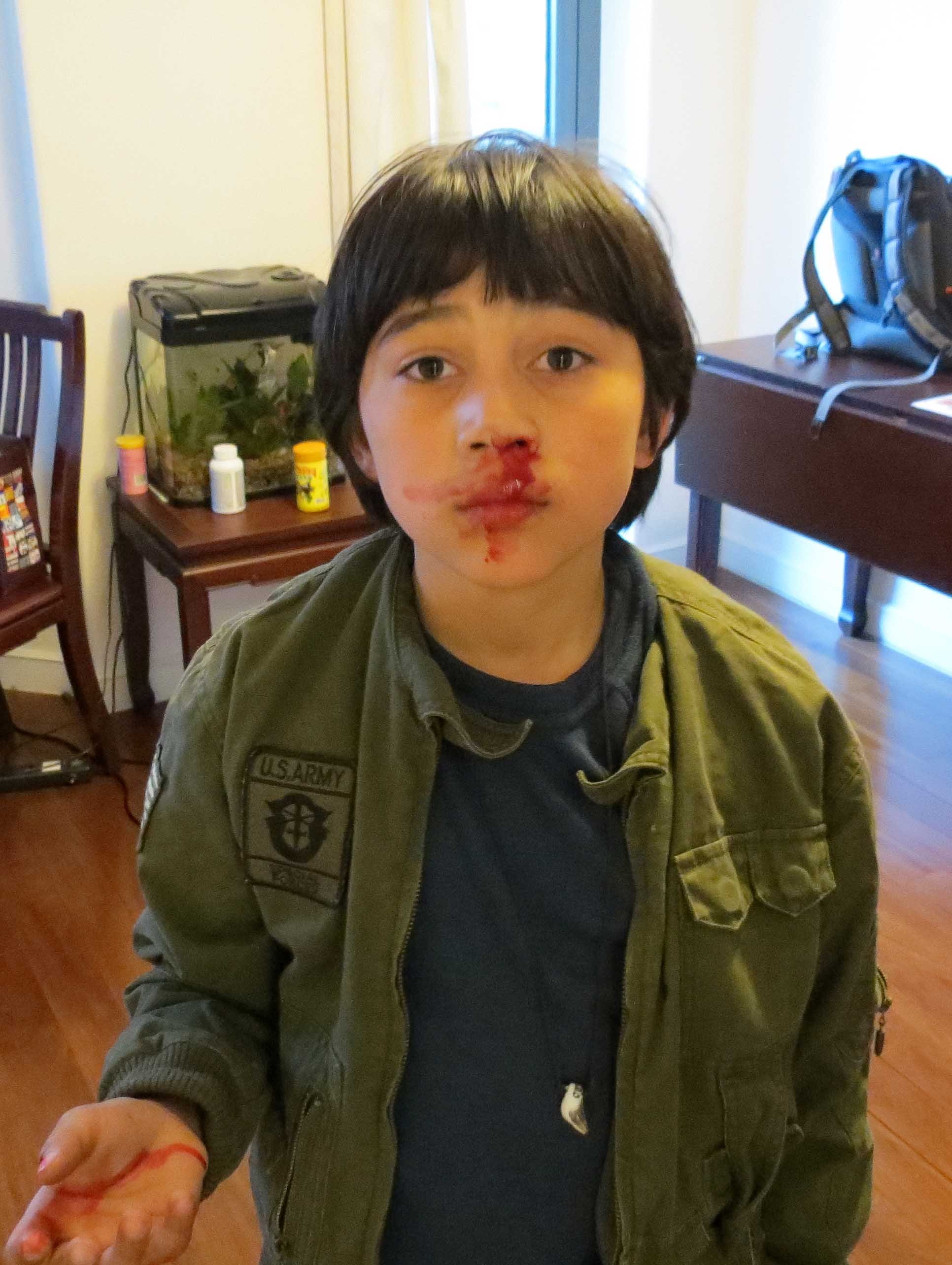 COKIE'S FIRST BLOODY NOSE MARCH 14 2012 (2).JPG