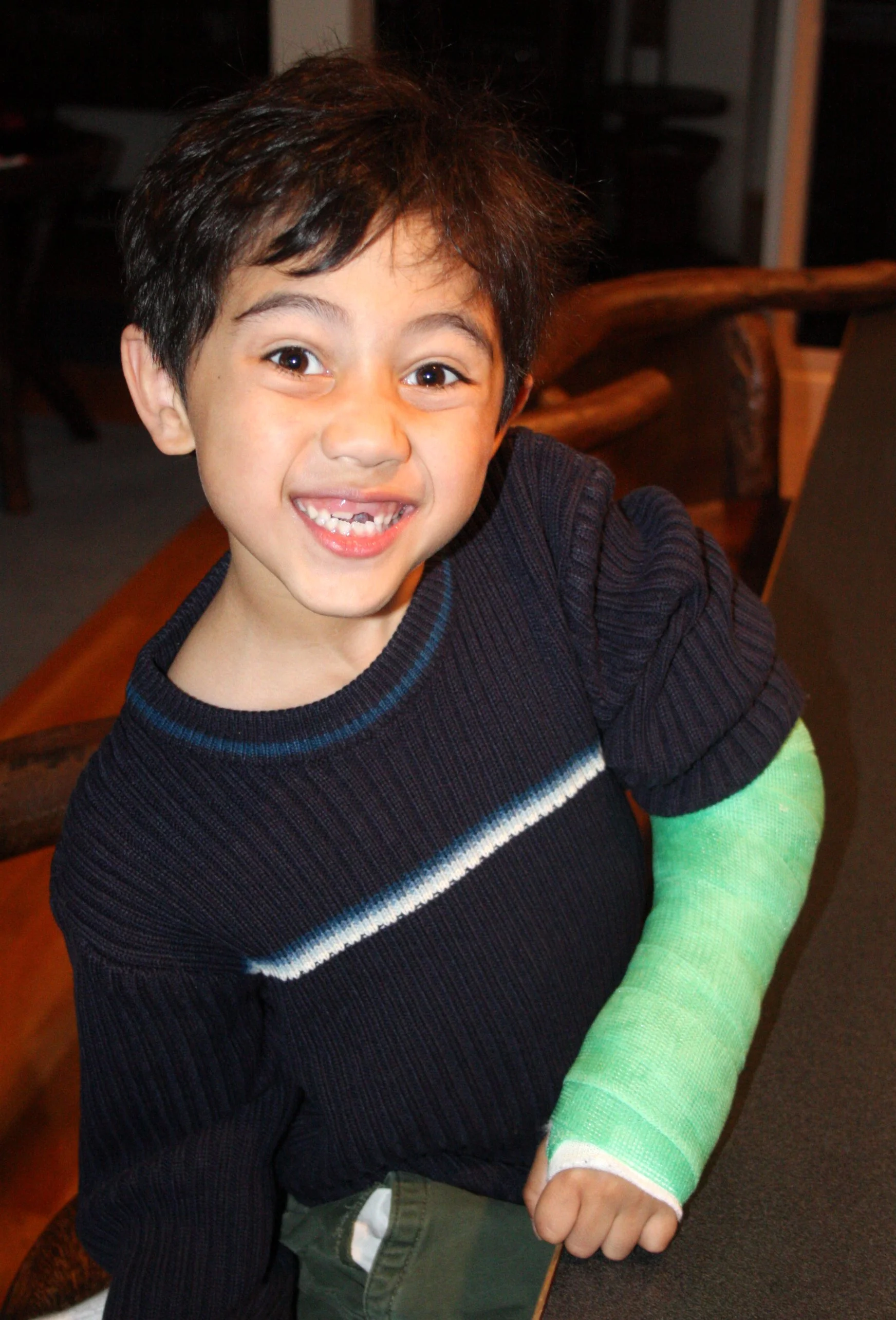 2008-10-12 COKIE BEING GOOFY WITH HIS BROKEN ARM.JPG