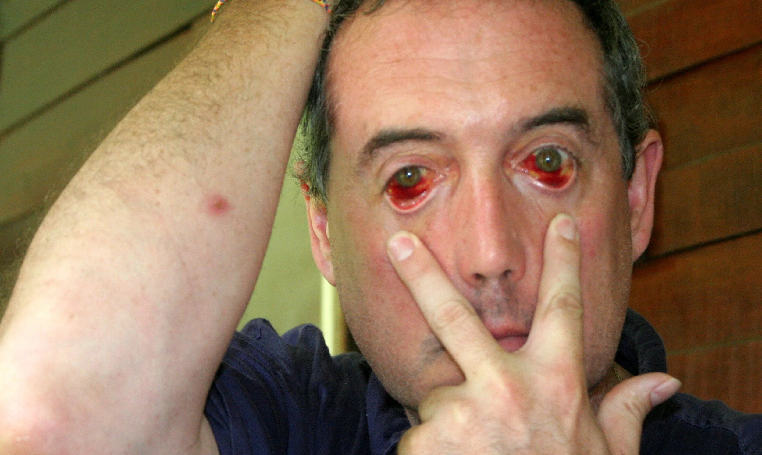 KINABATANGAN RIVER BORNEO - COKE'S SPIDER BITE TERMINATOR LOOK (2).JPG