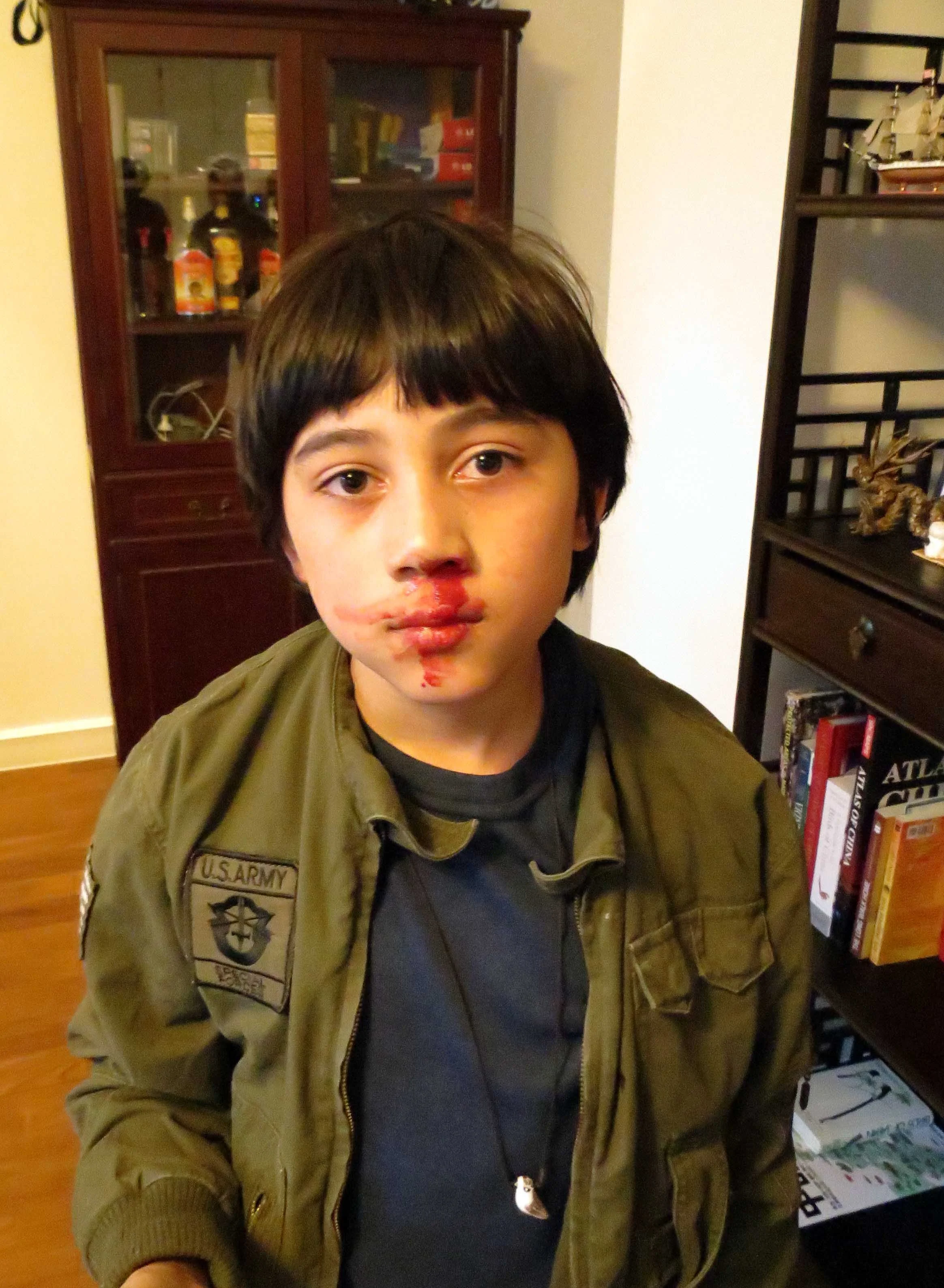 COKIE'S FIRST BLOODY NOSE MARCH 14 2012 (3).JPG