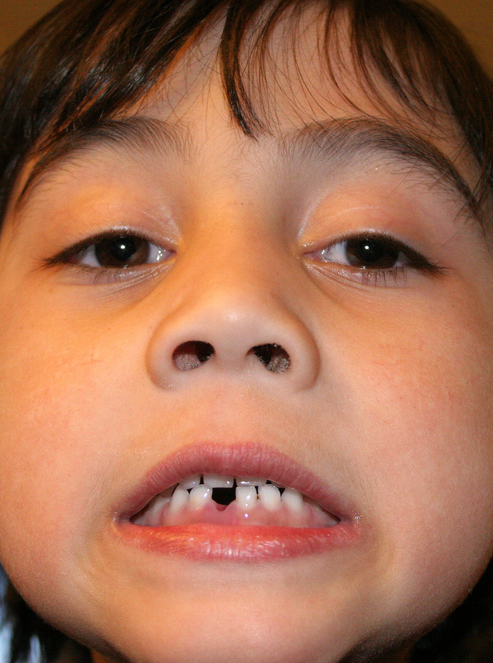 2008-4-20 COKIE'S FIRST TOOTH  (4).JPG